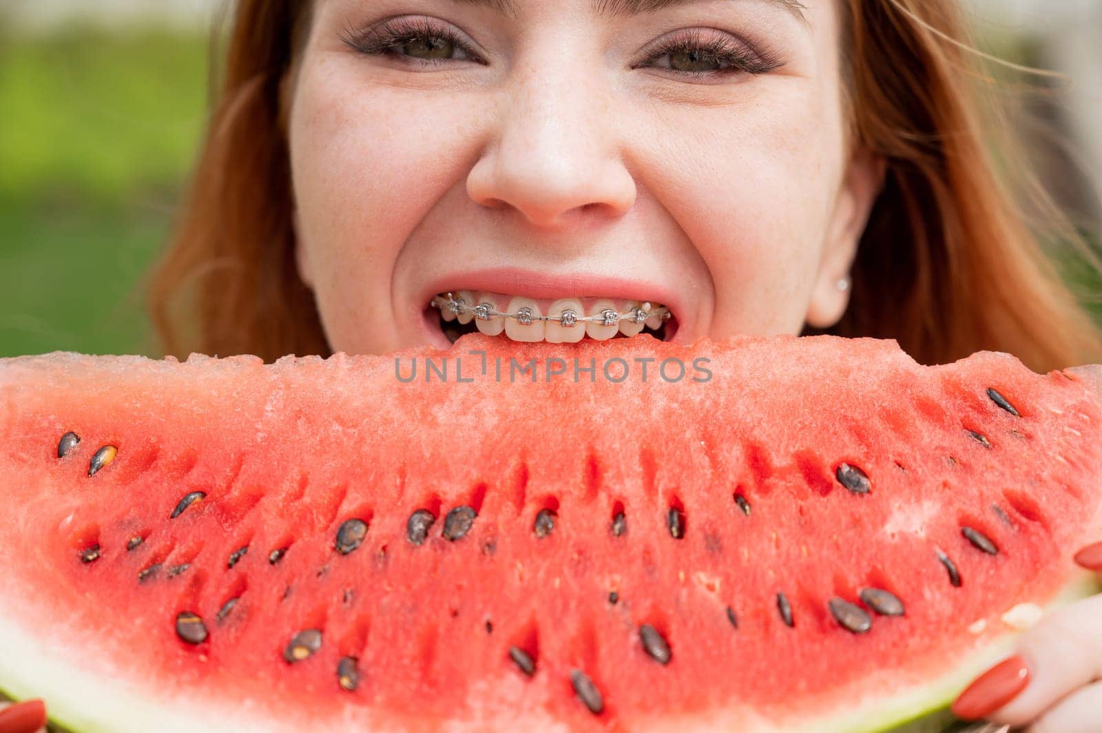 Close-up portrait of red-haired young woman with braces eating watermelon outdoors.