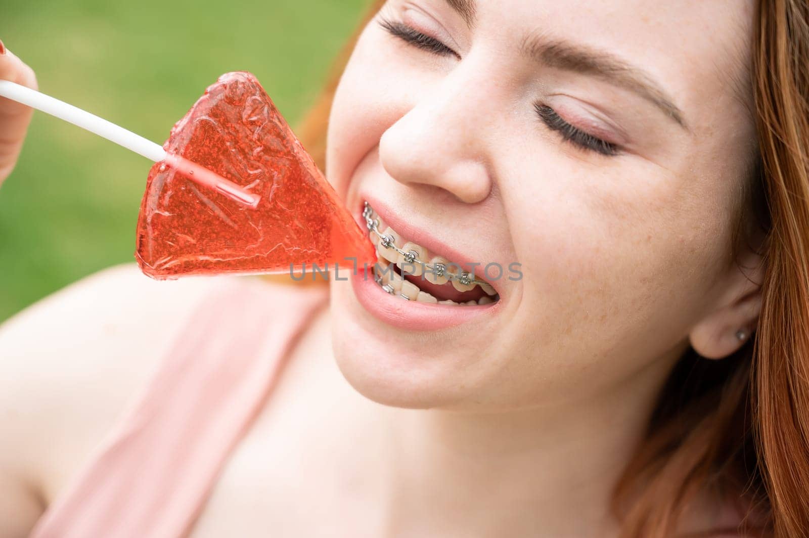 Beautiful young woman with braces on her teeth eats a watermelon-shaped lollipop outdoors