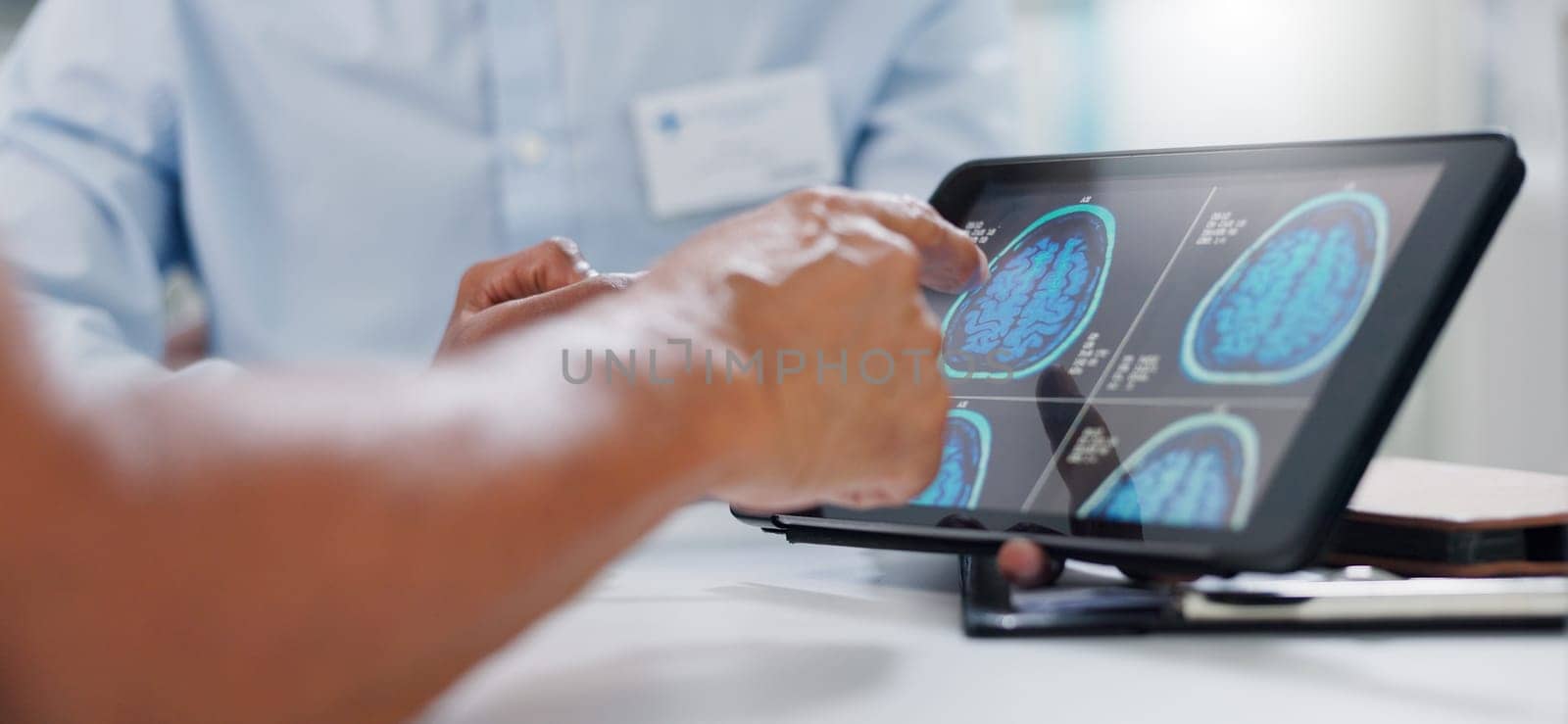Doctor, hands and tablet with brain scan for patient, consultation or examination results at hospital. Closeup of person, medical employee or nurse pointing to technology for MRI at neurology clinic.