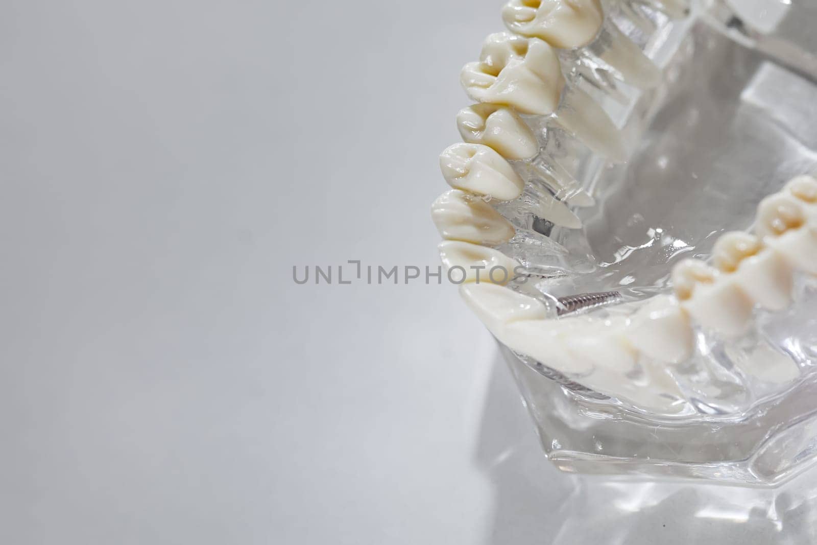 Teeth education model. Shallow dof by sarymsakov