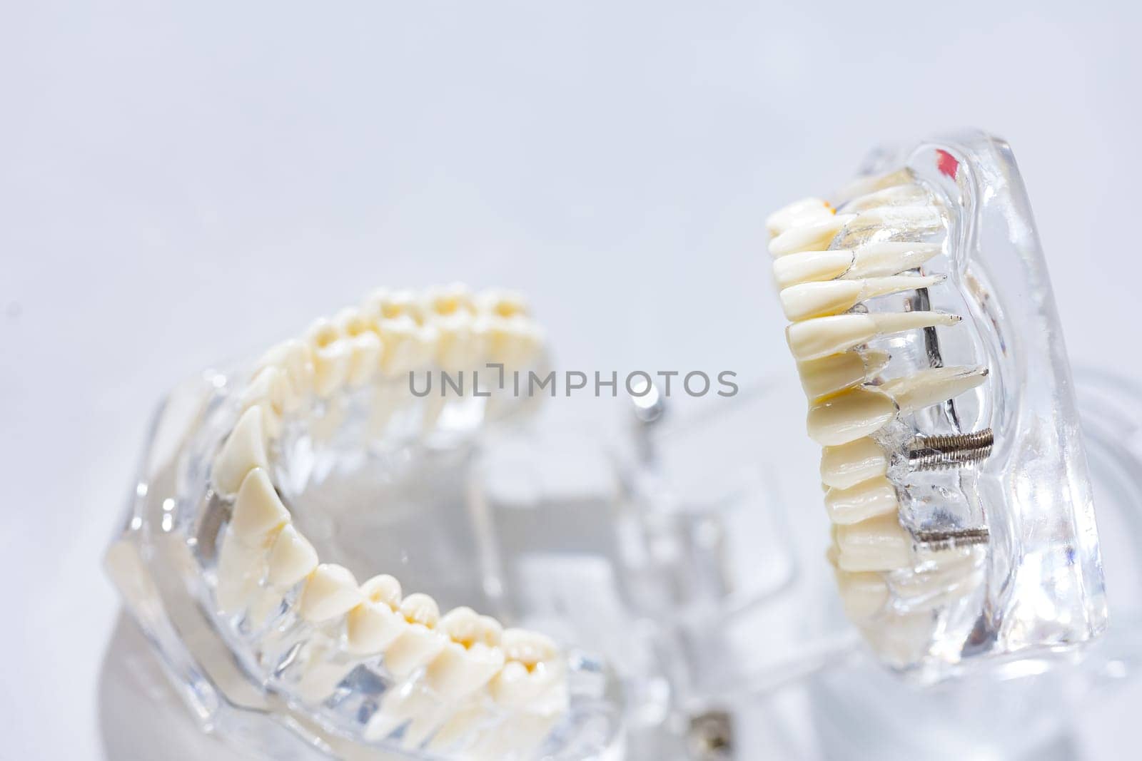 Model of human jaw. Selective Focus by sarymsakov