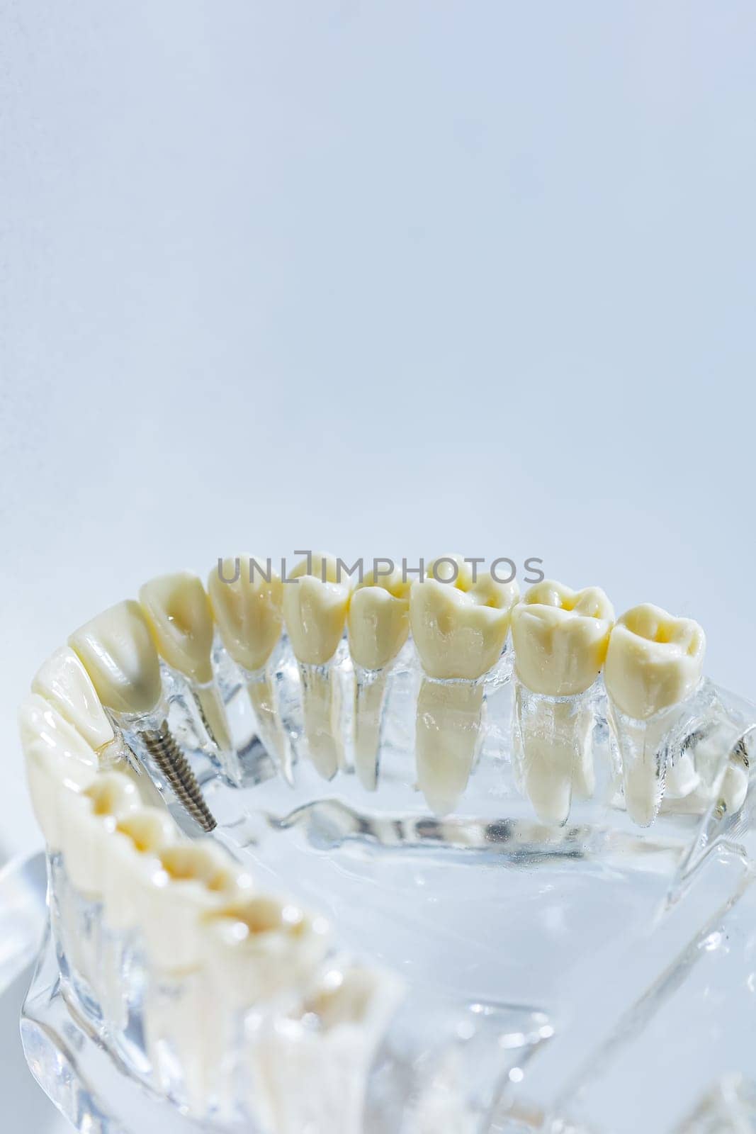 Teeth education model. Shallow dof by sarymsakov