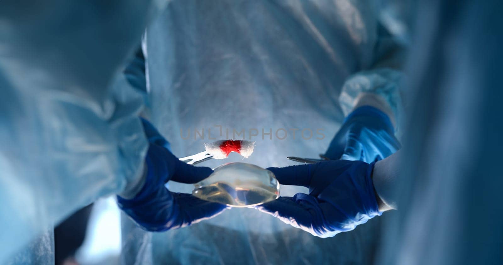Close-up of plastic surgeon doing implantation procedure with implants. Practitioner performing operation of augmentation mammoplasty. Anaplasty concept