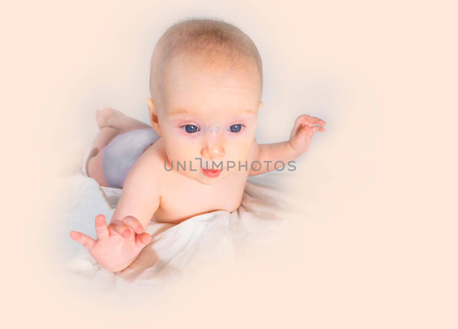 a baby with a hemangioma on his neck lies on a white background. banner with a copy space. profile of a little bald baby girl. the kid looks to the side