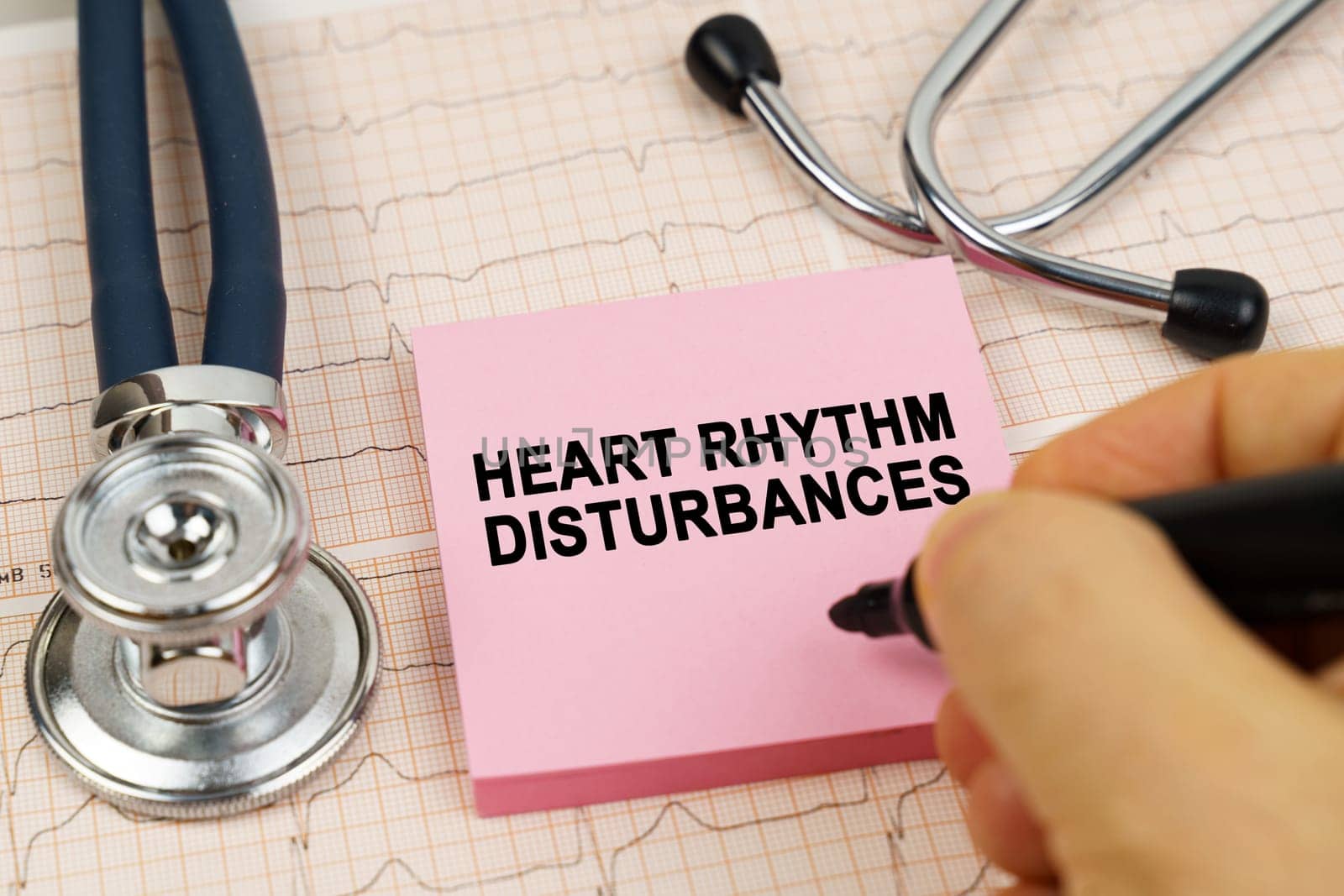 Medical concept. On the cardiograms there is a stethoscope and a sticker with the inscription - Heart rhythm disturbances