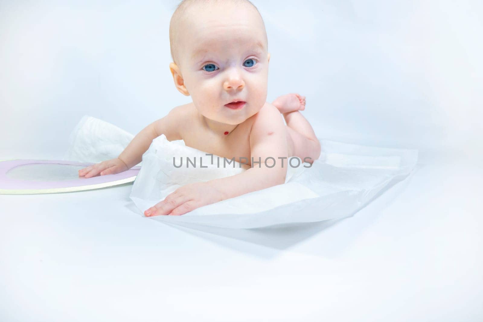 a baby with a hemangioma on his neck lies on a white background. banner with a copy space. profile of a little bald baby girl. the kid looks to the side