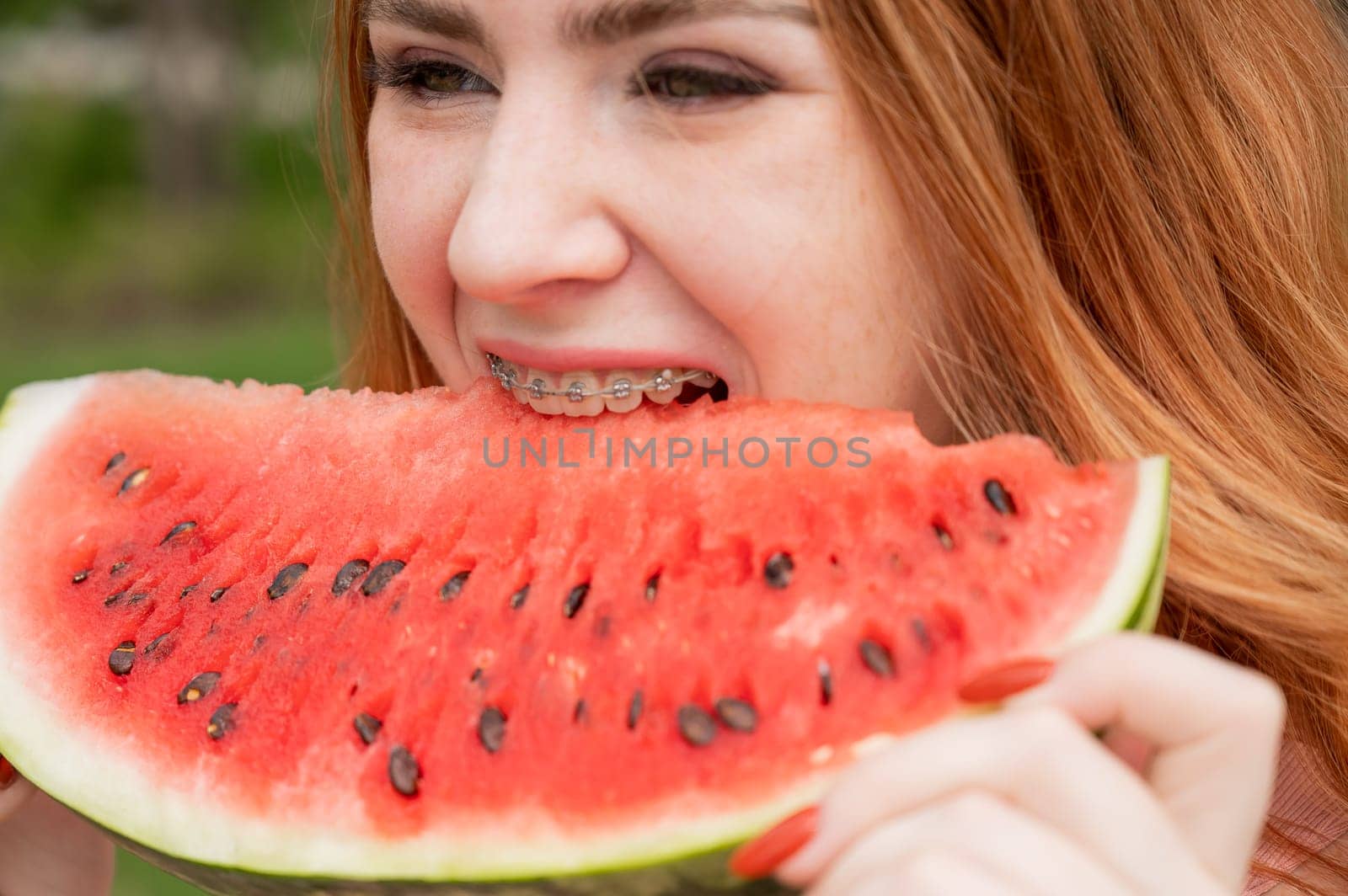 Close-up portrait of red-haired young woman with braces eating watermelon outdoors by mrwed54