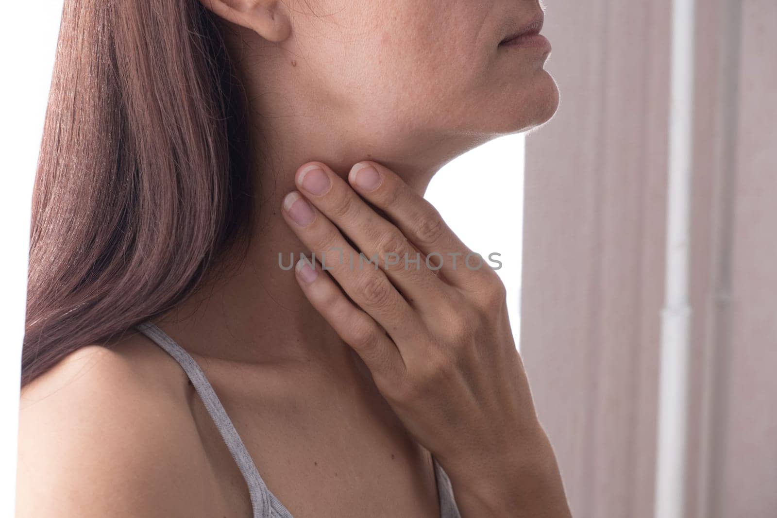 Cervical lymphadenitis of the right side in a woman