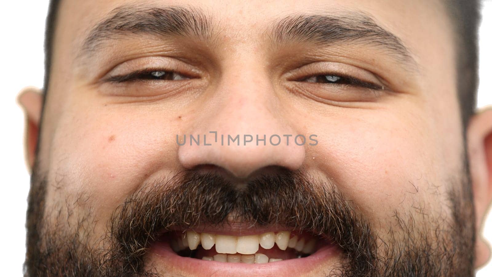 Man's eyes, close-up, on a white background.