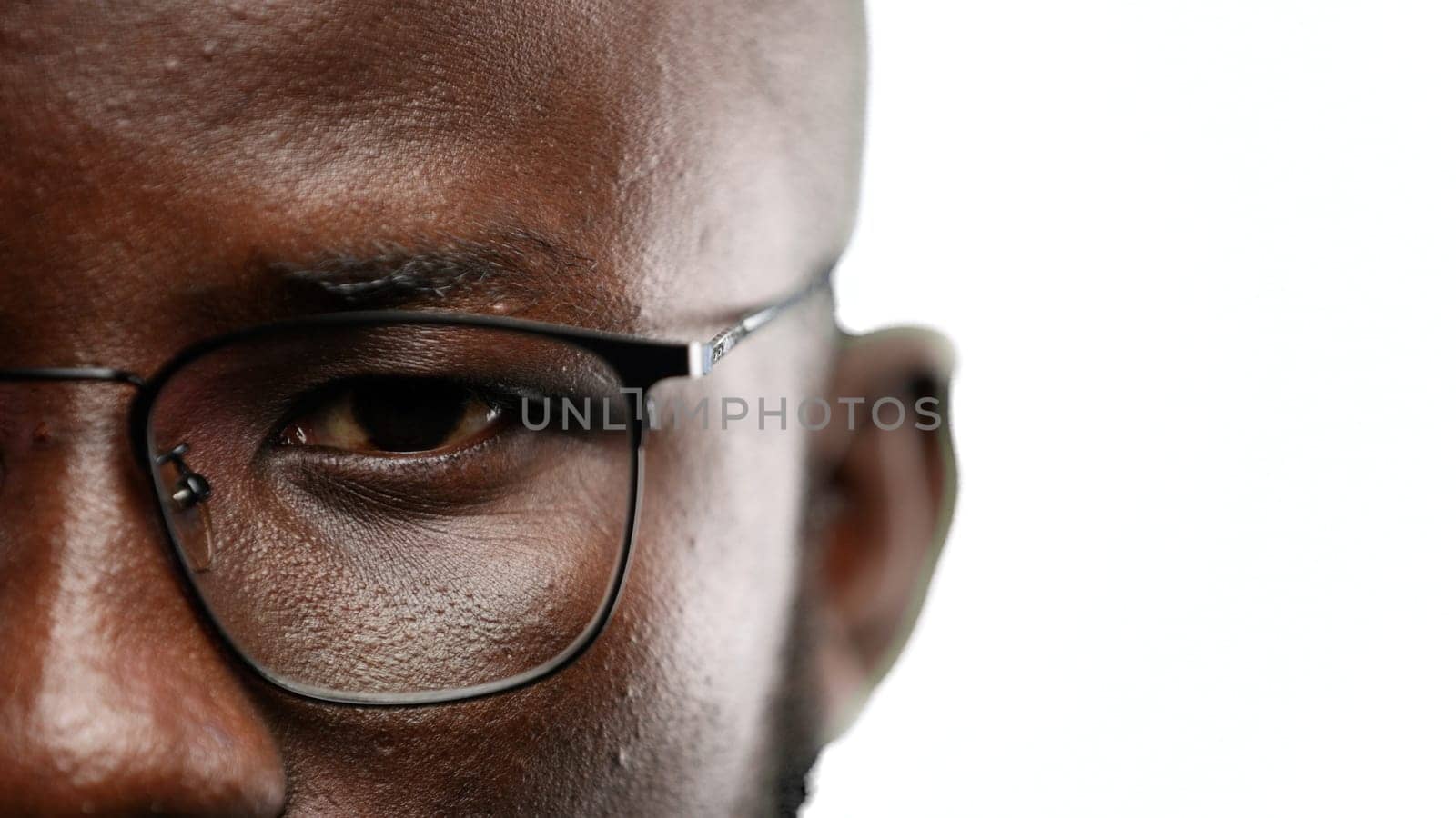 Man's eyes, close-up, on a white background.