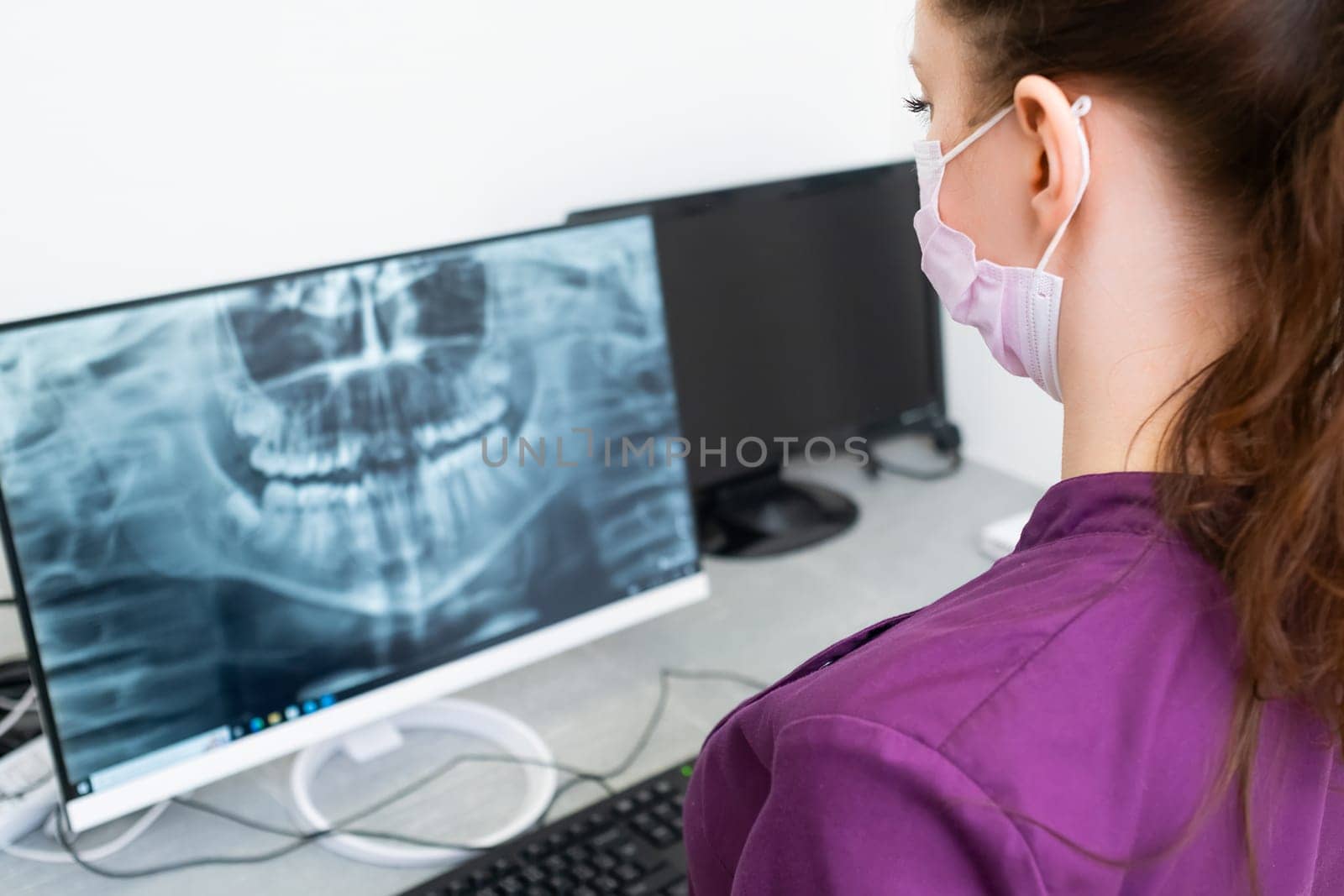 Dentist analyzing x ray of teeth on the screen of the computer