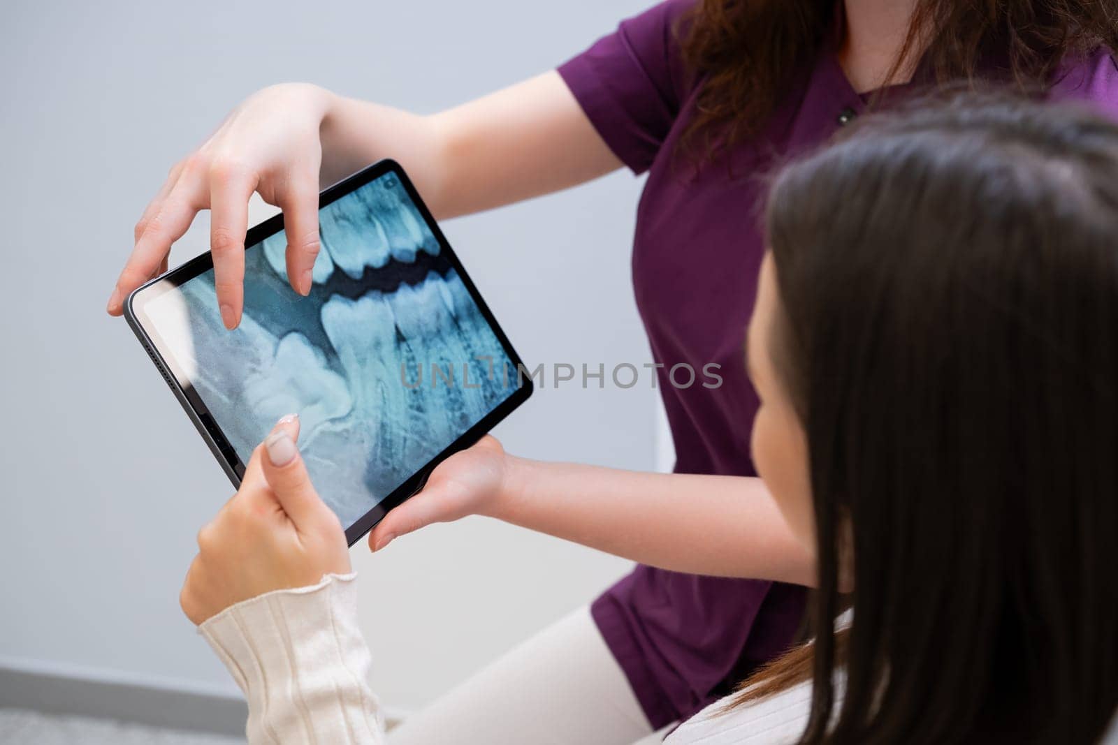 Dentist discussing tooth extraction procedure with patient showing x-rays.