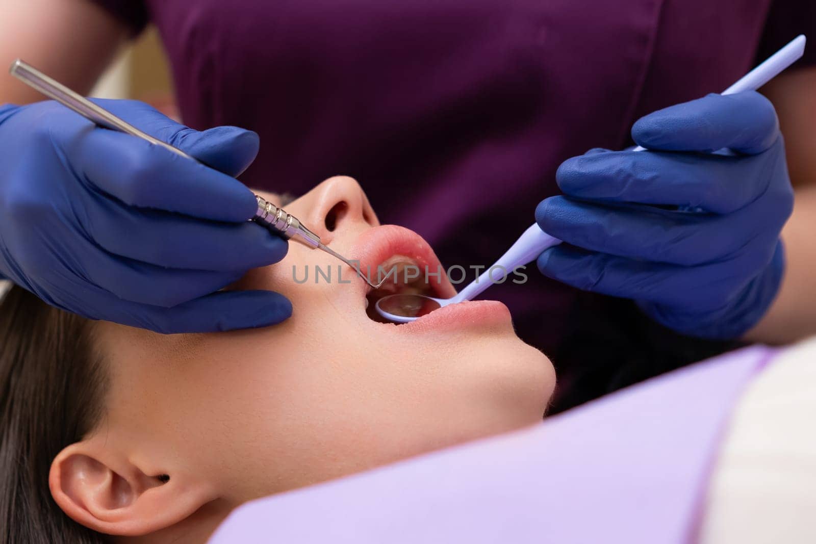Close up dentist examining teeth of patient during appointment at dental office.