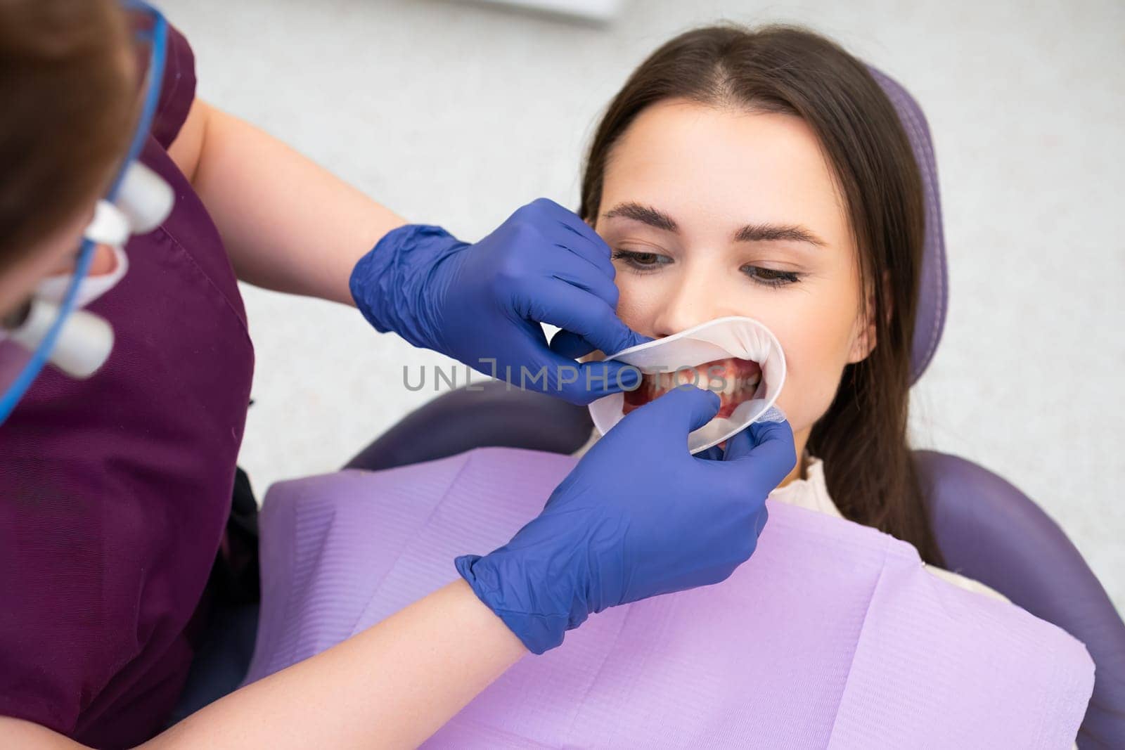 Orthodontist inserts an elastic ring into the mouth of the patient. by vladimka