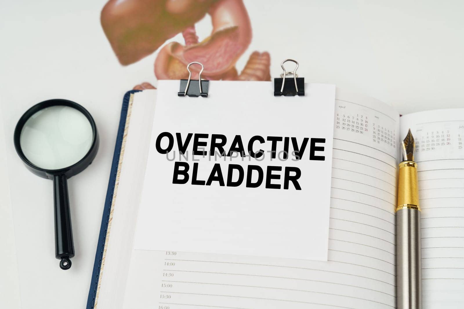 Medical concept. On the table there is a magnifying glass and a notepad with the inscription - Overactive bladder