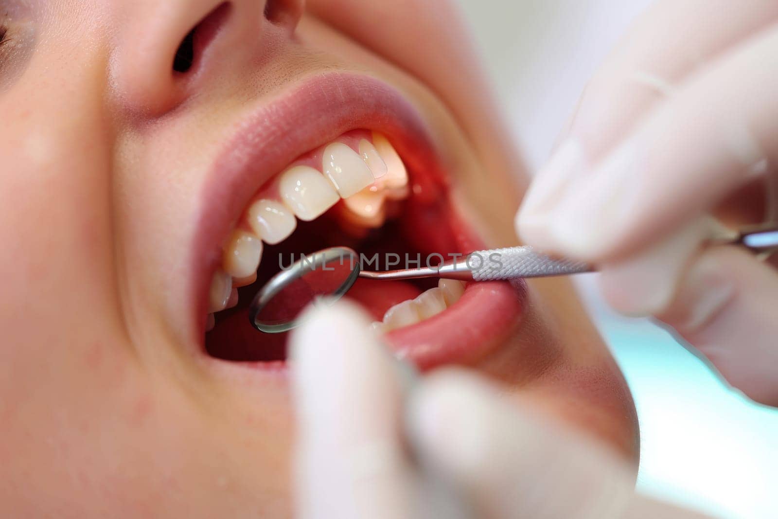 Dental treatment. Close up of female at dentist office, getting check up. Generative AI.