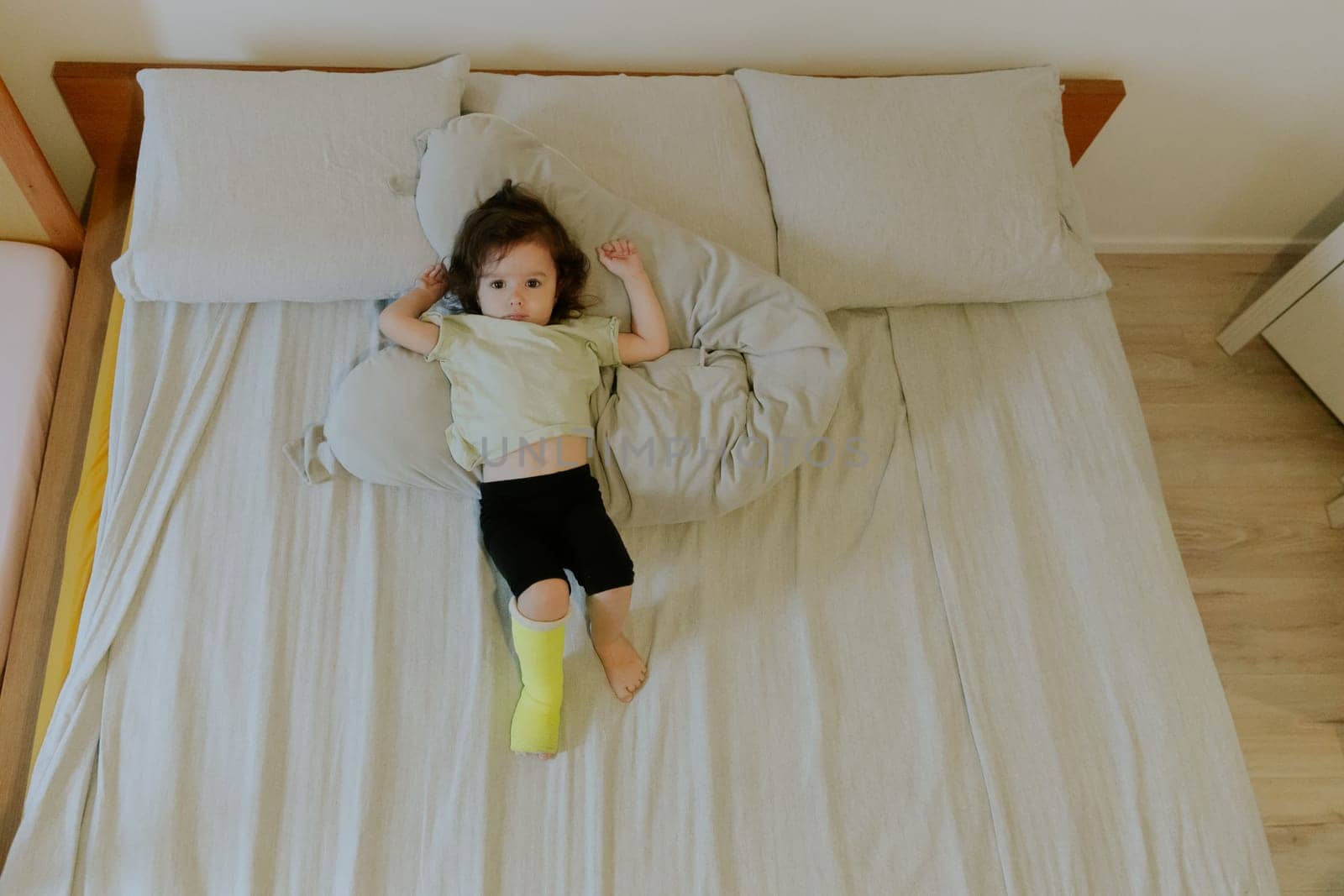 One beautiful little Caucasian girl baby with a serious emotion and a green cast on her leg lies on her back on the bed fooling around and playing in the morning in the room, flat lay close-up.