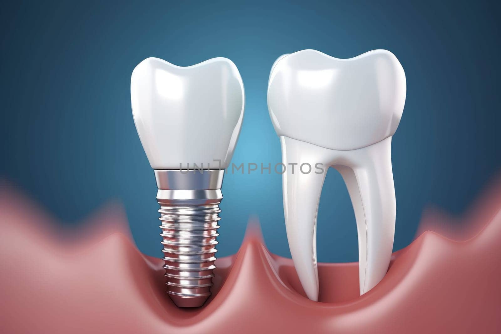 Realistic dental implant. Teeth treatment by ylivdesign