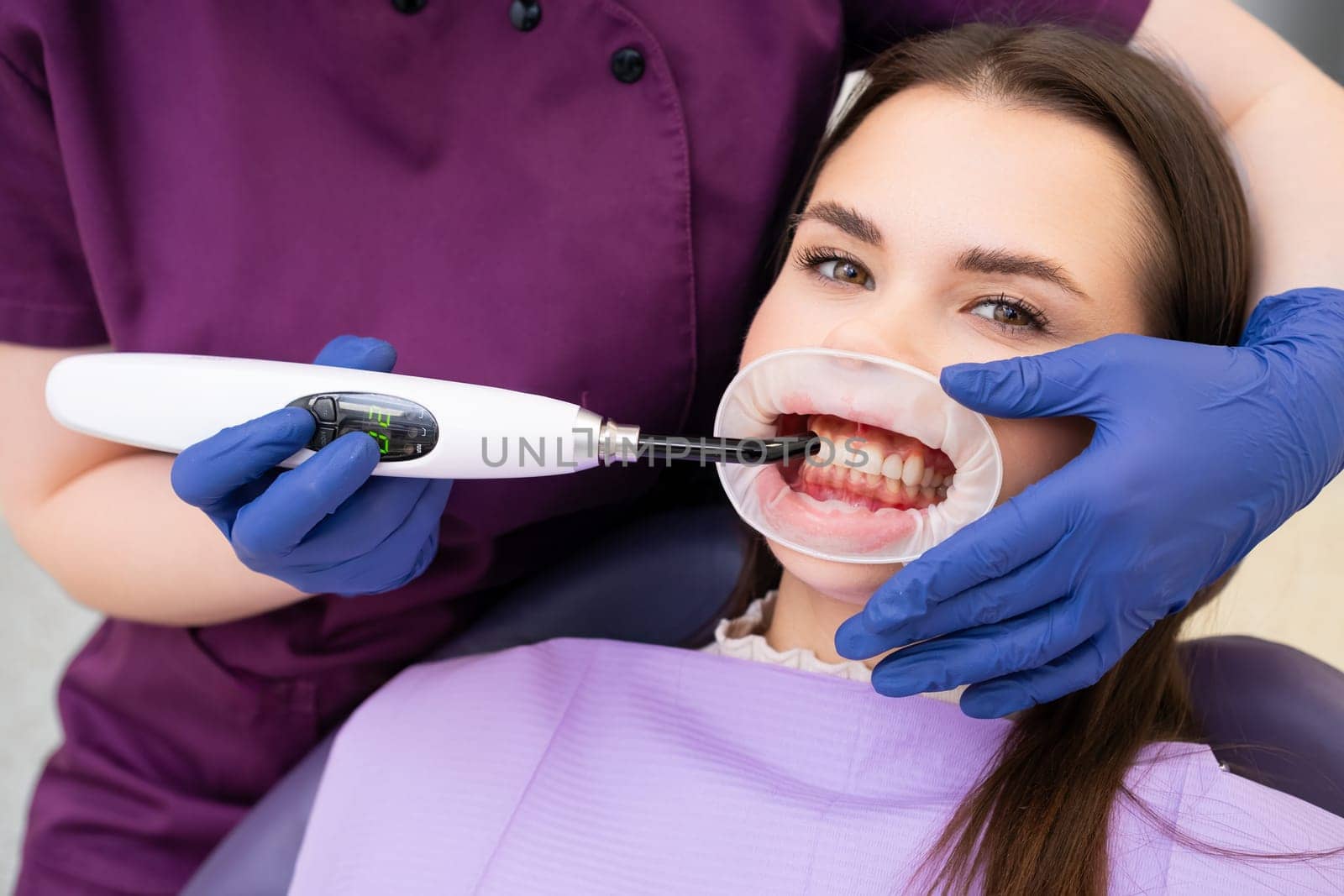 Dentist working with dental polymerization UV lamp in oral cavity for beautiful female patient.