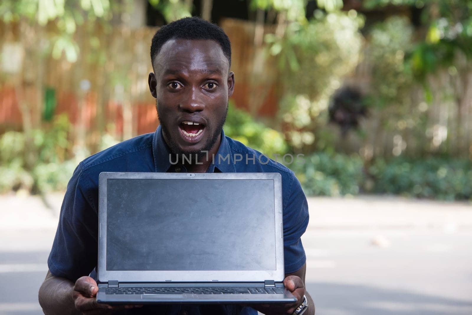 young man with laptop sitting outdoors looking at the camera looking surprised.