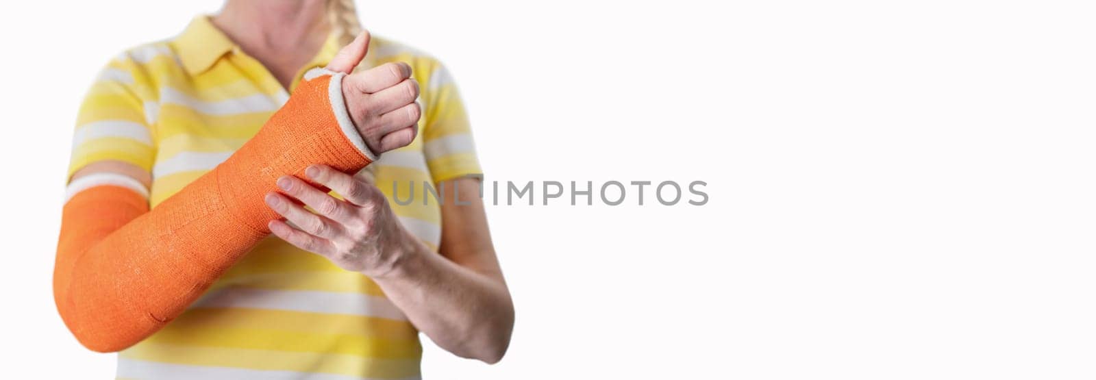 woman with a broken arm and an orange plaster plastic bandage on a white background,modern materials for the treatment of injuries,the latest medicine,copy space,High quality photo