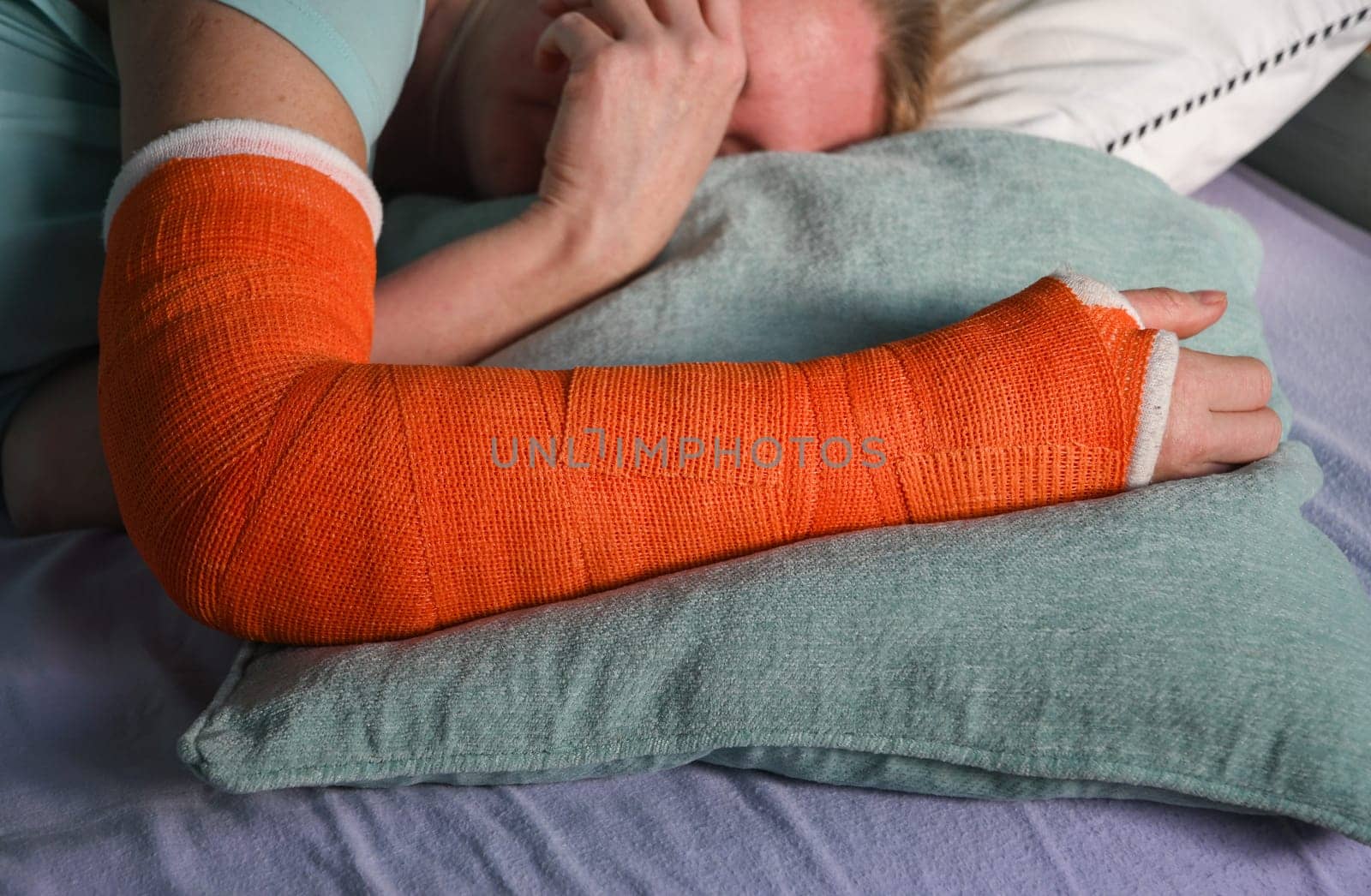 woman with a broken right arm with an orange fiberglass plaster cast sleeps in bed with a pillow under the cast by KaterinaDalemans