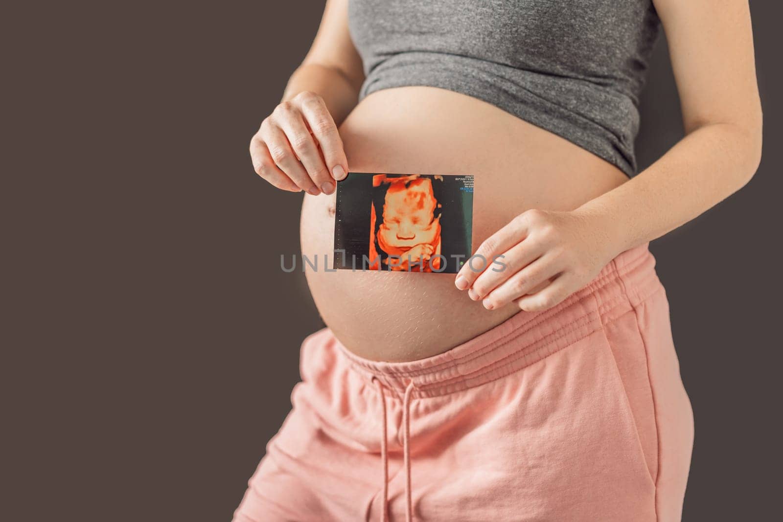 Expectant mother tenderly connects with her unborn child, holding ultrasound photo to her pregnant belly by galitskaya