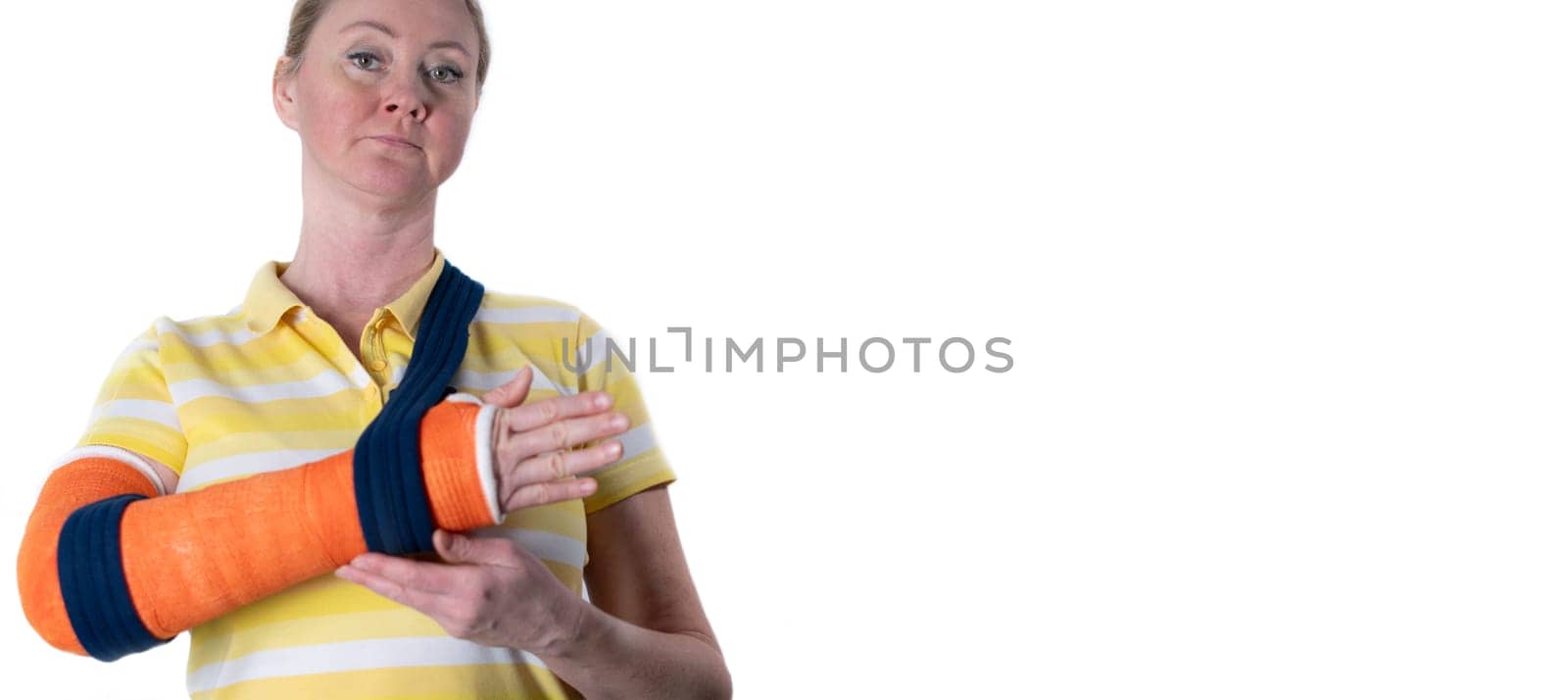woman with broken right arm wearing plaster casts to hold broken bones in place until they heal,hanging her arm in a sling, modern treatments, on a neutral background,copy space, High quality photo