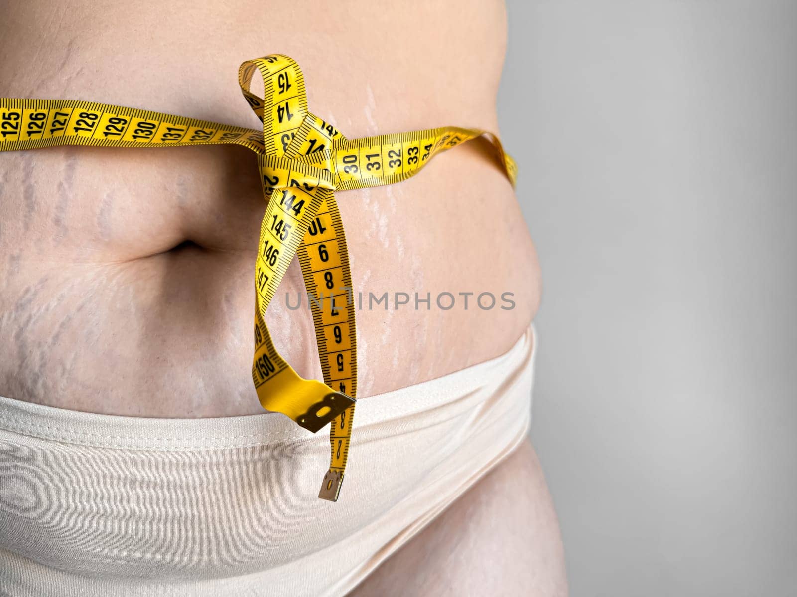 Body positivity and self love concept with yellow measuring tape tied in bow around womans stomach showing stretch marks on neutral background. High quality photo