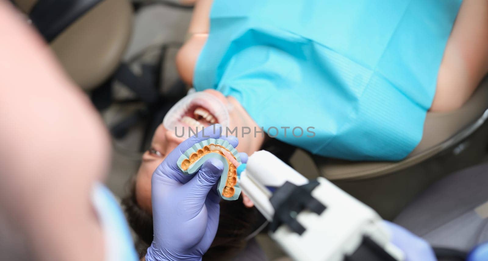 Removal of casts for the manufacture of veneers. Dentist is holding cast for dental veneers in hands.