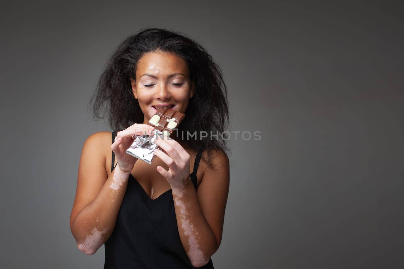 Smiling African American woman with Vitiligo disease eating chocolate. Beautiful young lady with dark hair having sweet food against gray background. Black lady with skin problem.
