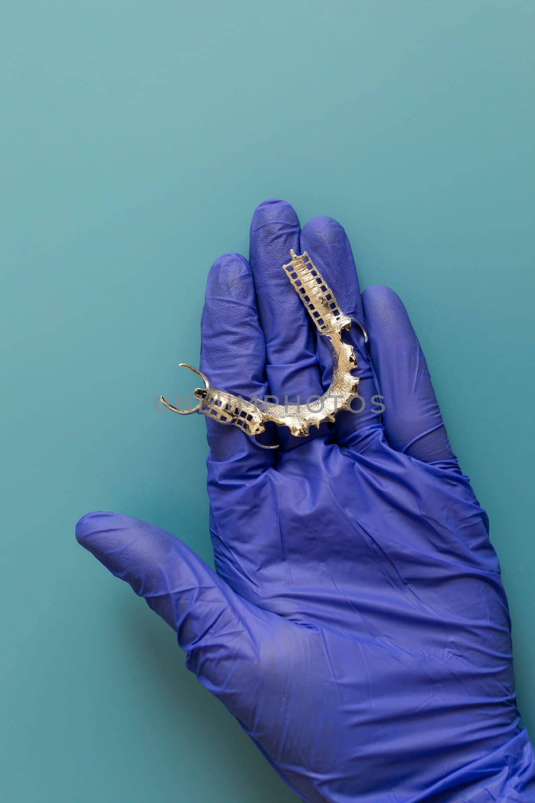 Metal Frame Lower Partial Denture, Cobalt Chrome Dental Plate, Bridge Printed By 3d Printer in Doctor's Hand. Blue Background. Flat Lay Mockup. Copy Space For Text. Vertical Plane. Dentistry.