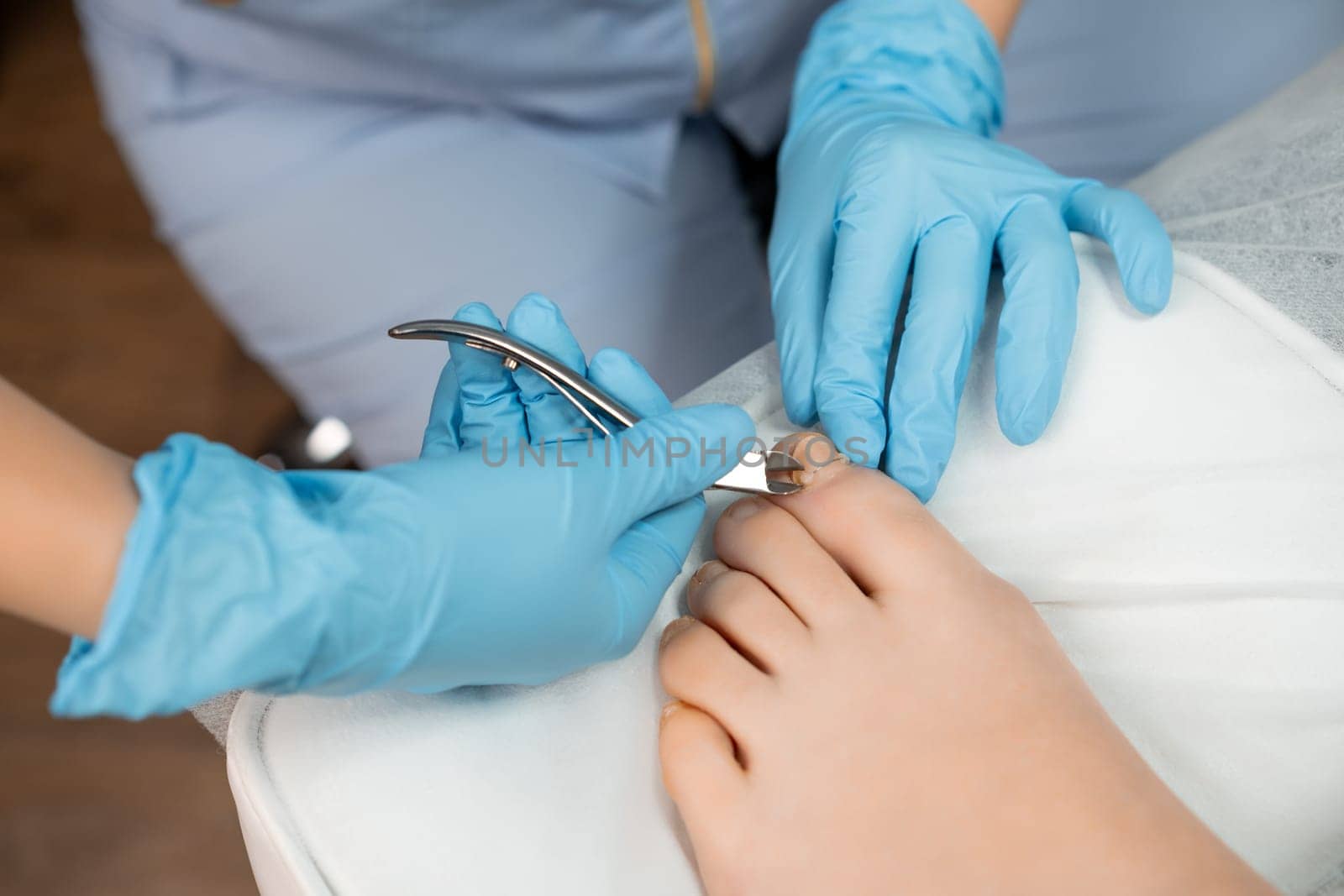 Podiatrist uses nippers cutter to remove ingrown toenail in the clinic.