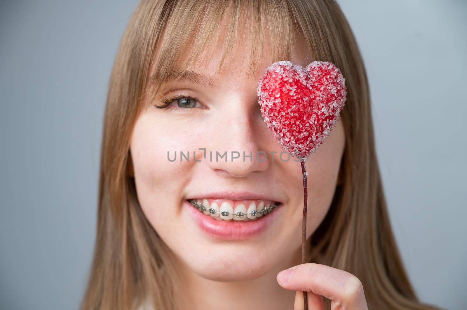 Cute woman with braces on her teeth holds a candy in the form of a heart on white background.