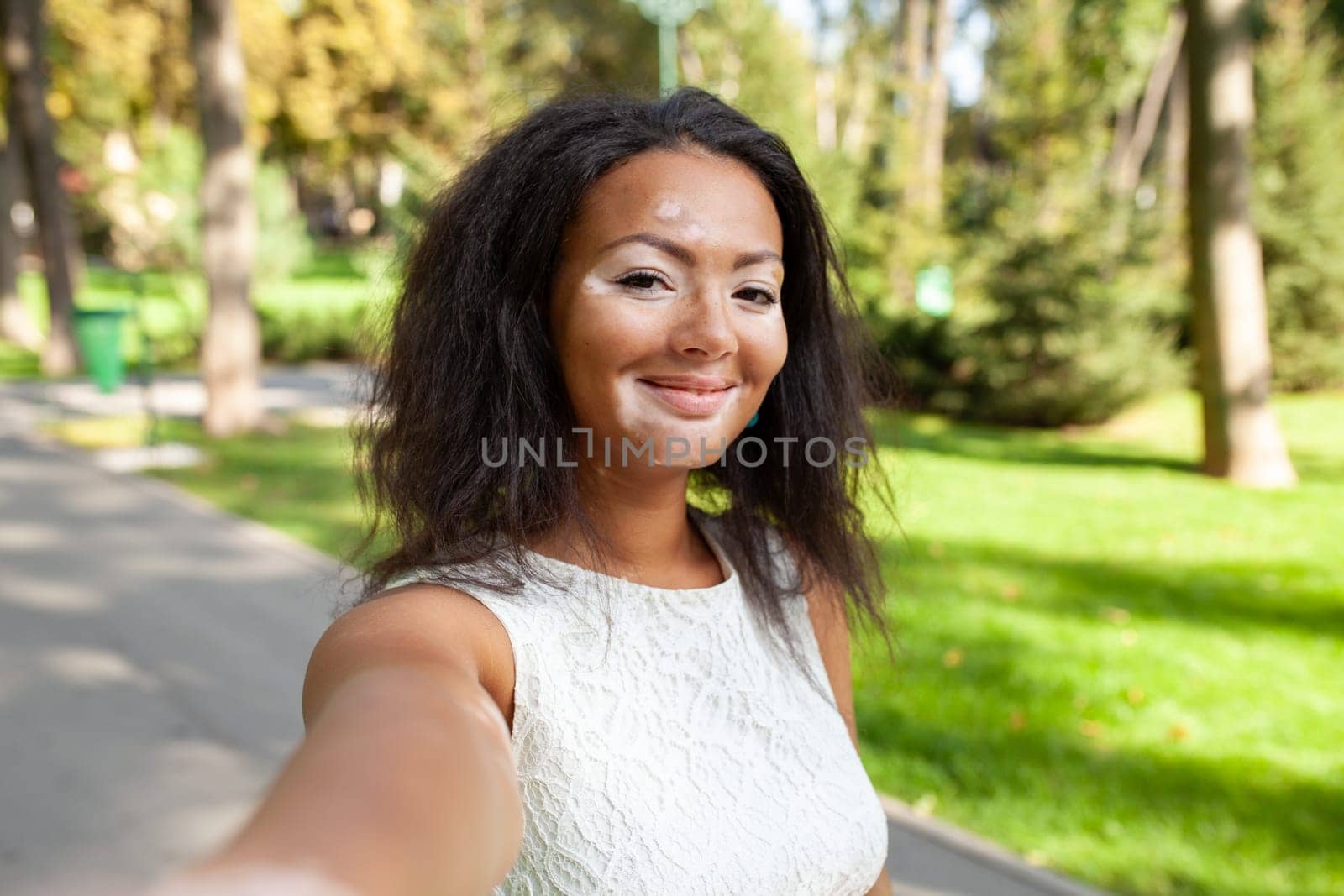 Smiling woman with vitiligo disease taking selfie in park during weekend by andreonegin