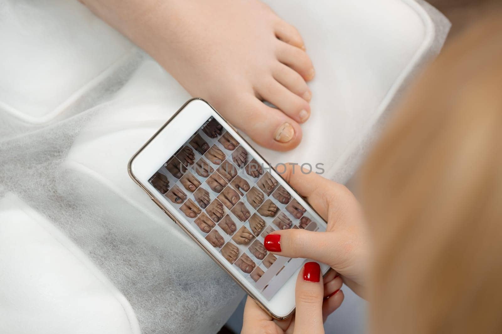 Close up a smartphone with photos of clients toenails in podologist hands. by vladimka