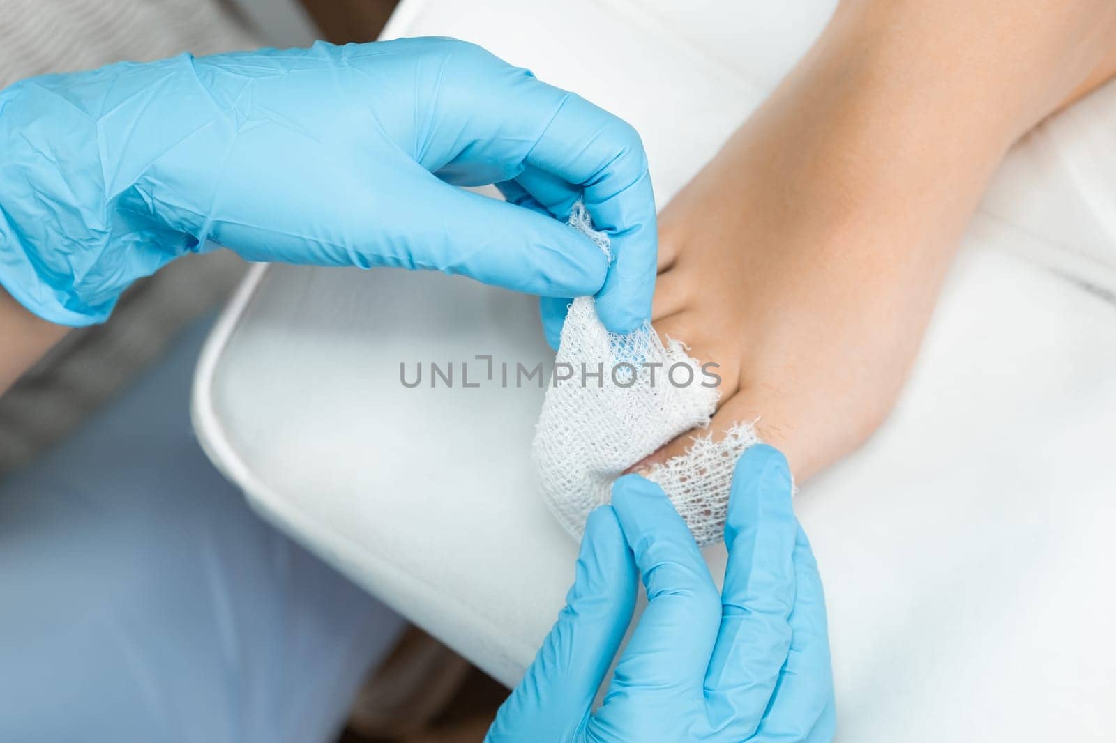 Podologist uses a bandage to apply antiseptic to the toe after nail removal.