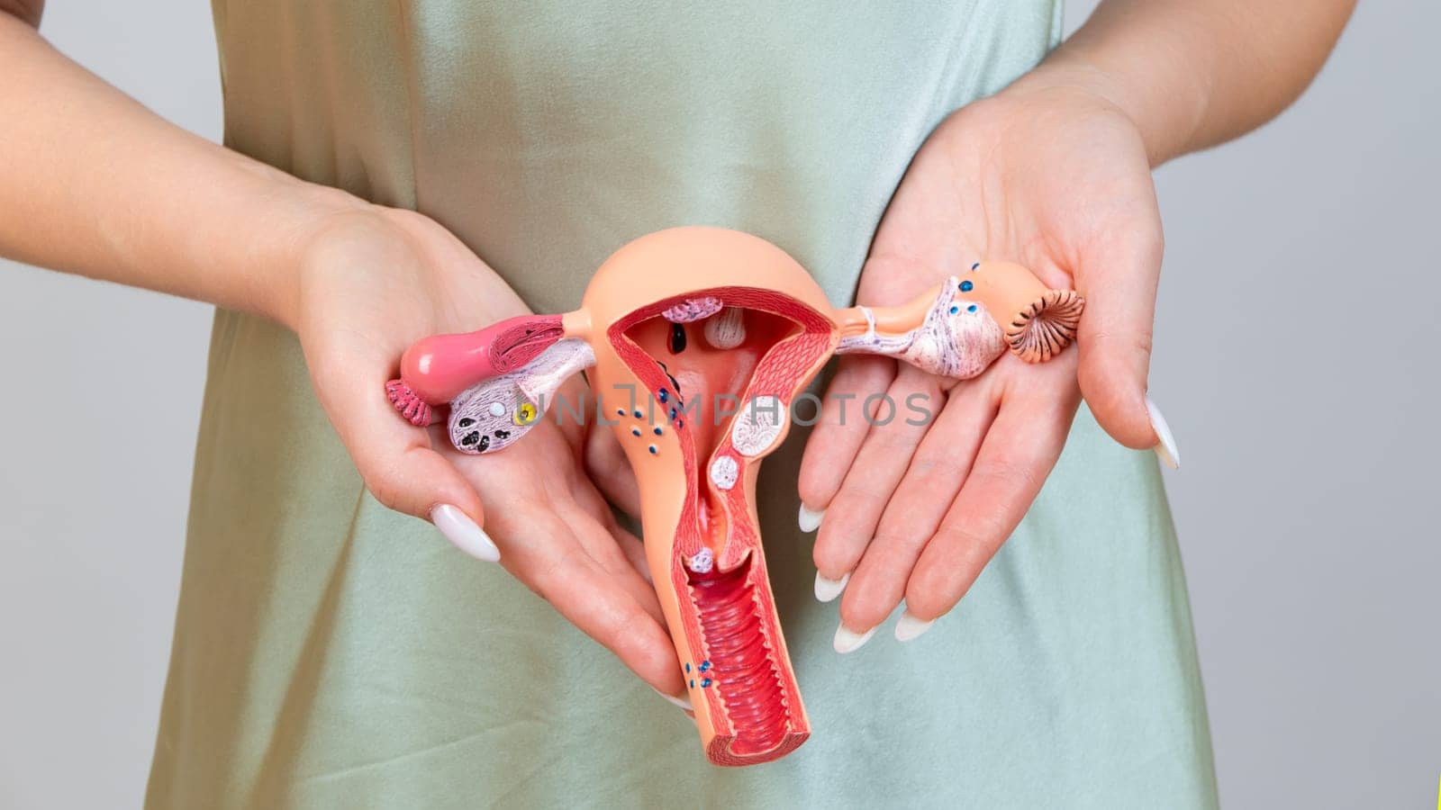 Asain woman holds model of female reproductive system in the hands. Help and care concept