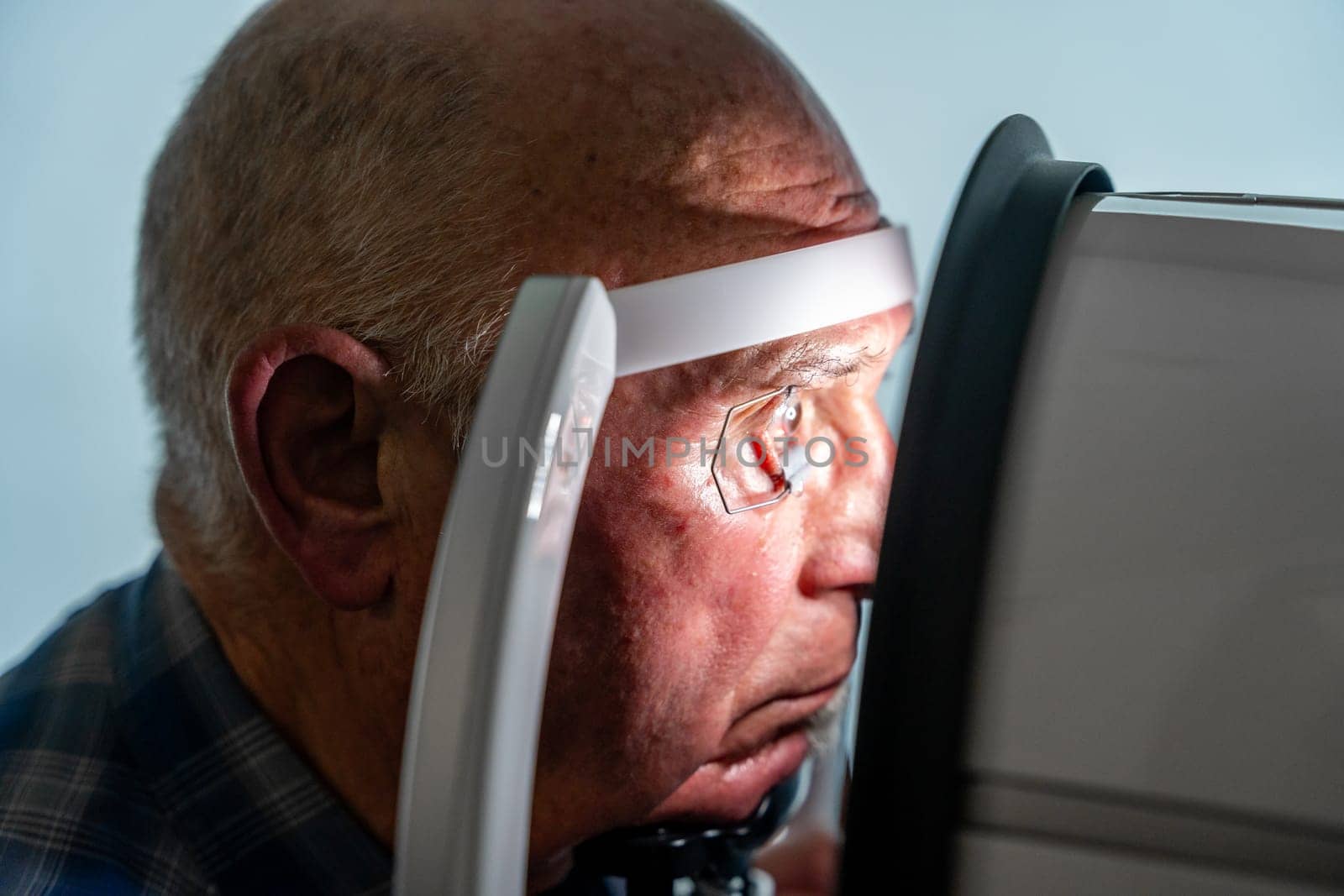 Man with eye opener during a laser treatment for glaucoma by Huizi