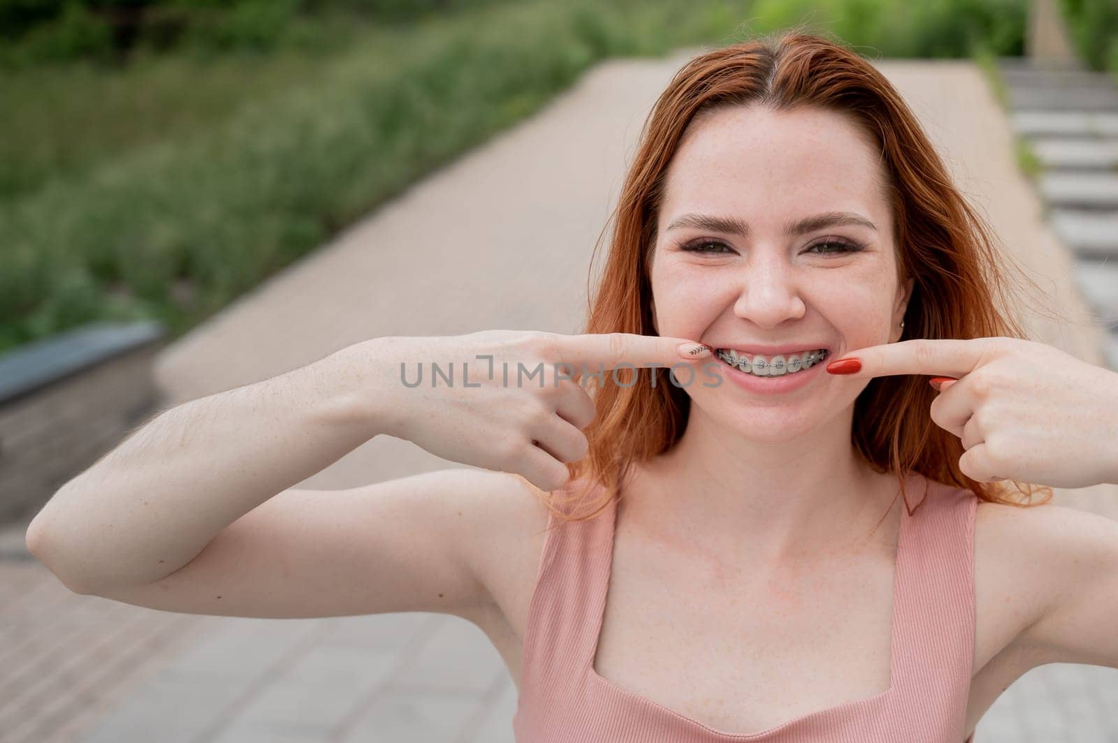 Young red-haired woman with braces on her teeth point to a smile outdoors in summer by mrwed54