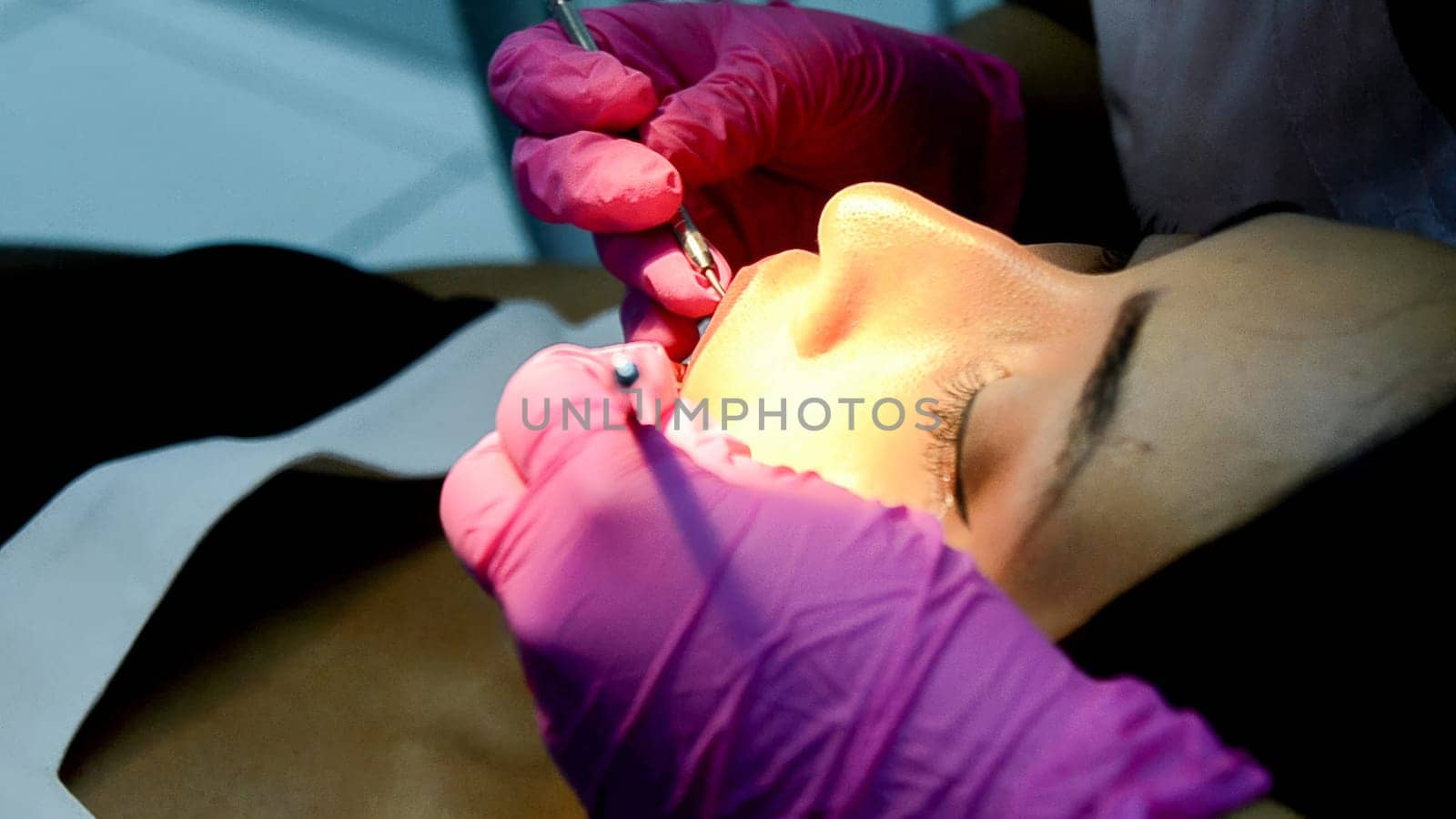 Close-up shot of a professional dentist performing a dental procedure on a patient in a well-equipped dental clinic
