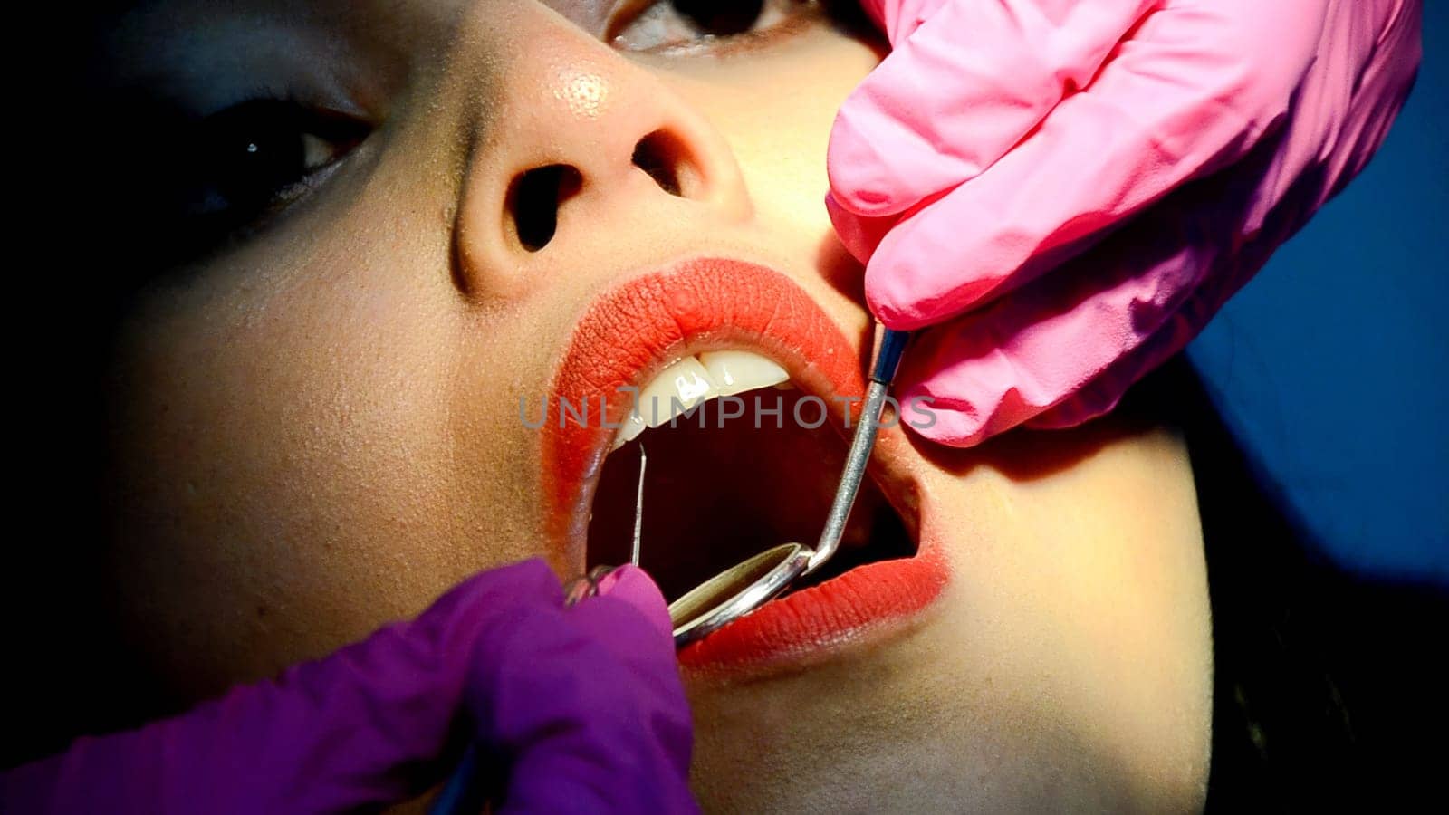 Close-up dental examination in dentist's office with oral care and hygiene checkup for patient's tooth health