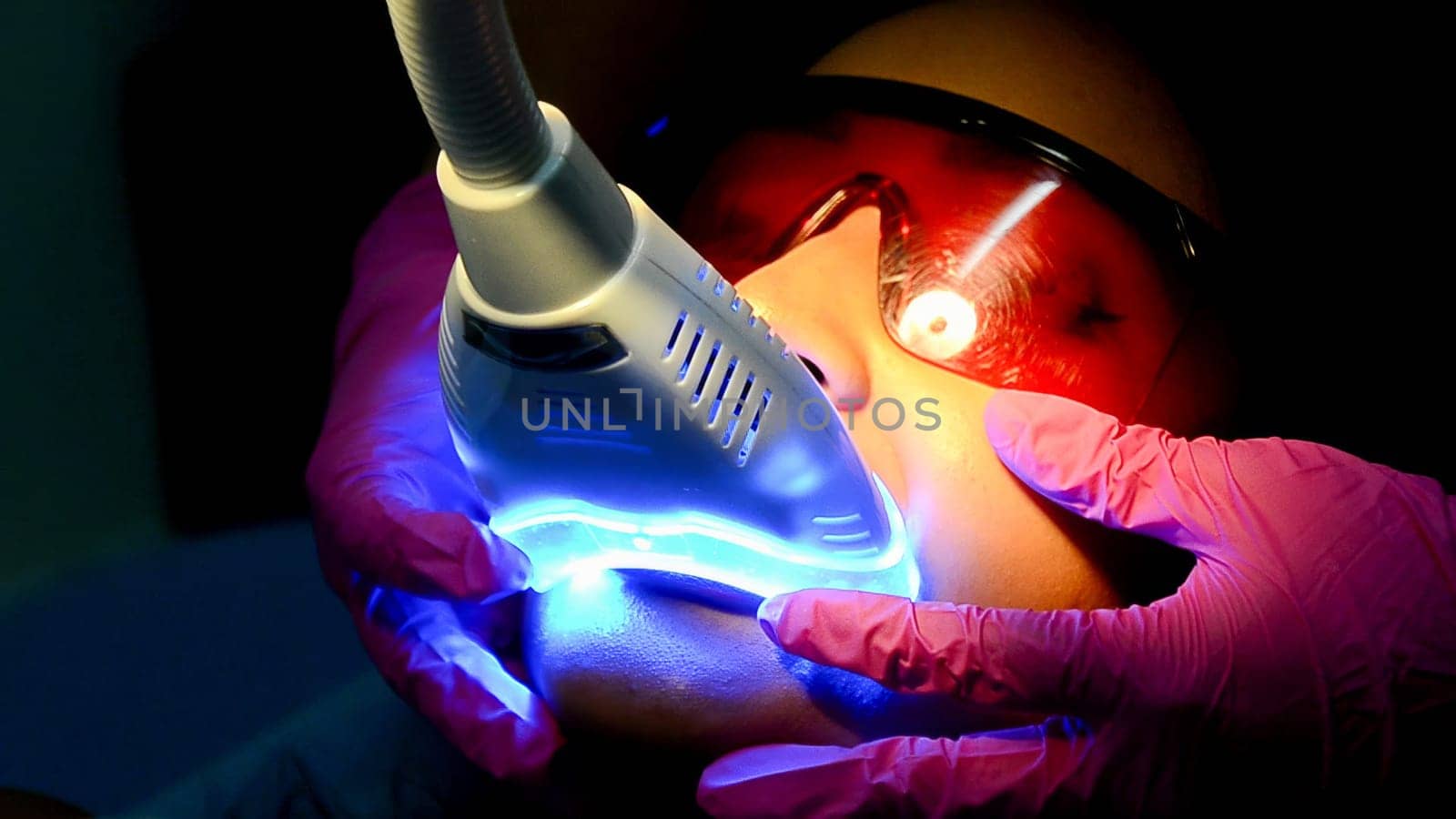 Innovative dental treatment with ultraviolet light by Peruphotoart