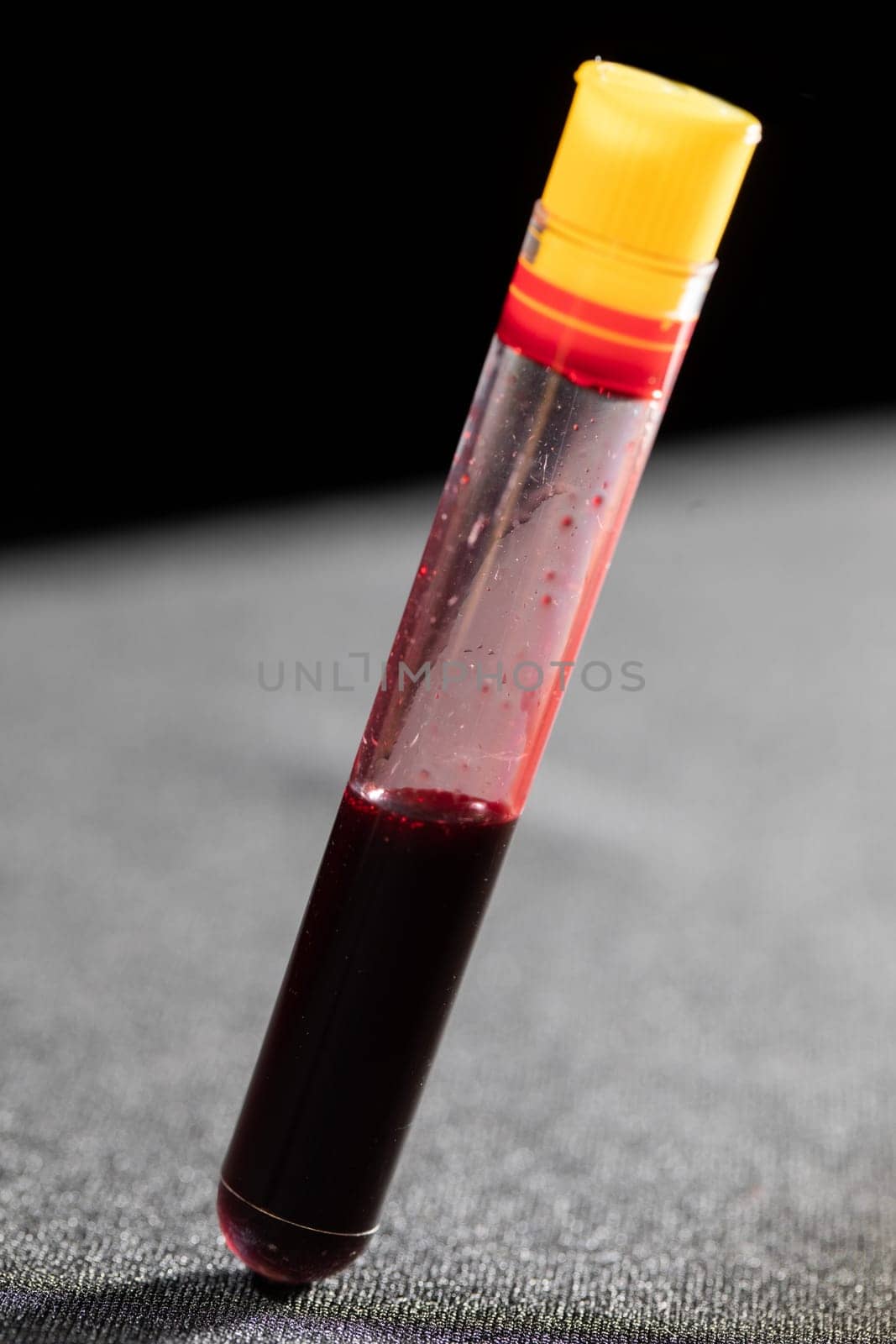 Each blood vial is transported to the laboratory for specialized tests.