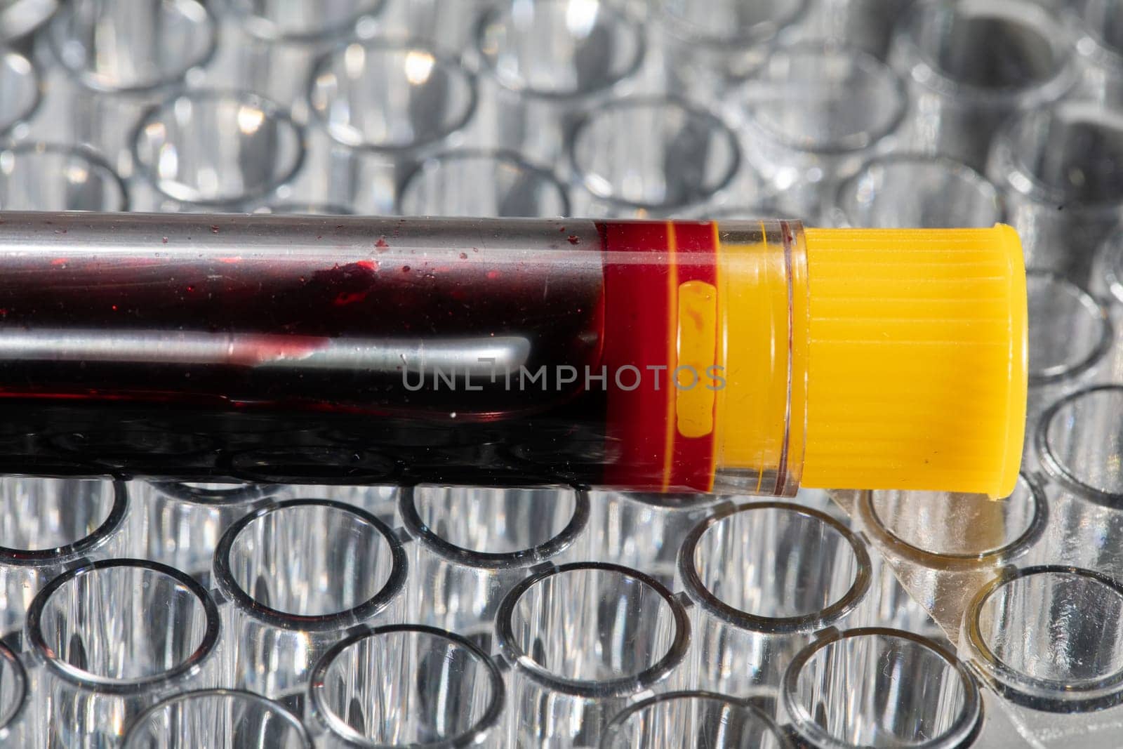 Each blood vial is transported to the laboratory for specialized tests.