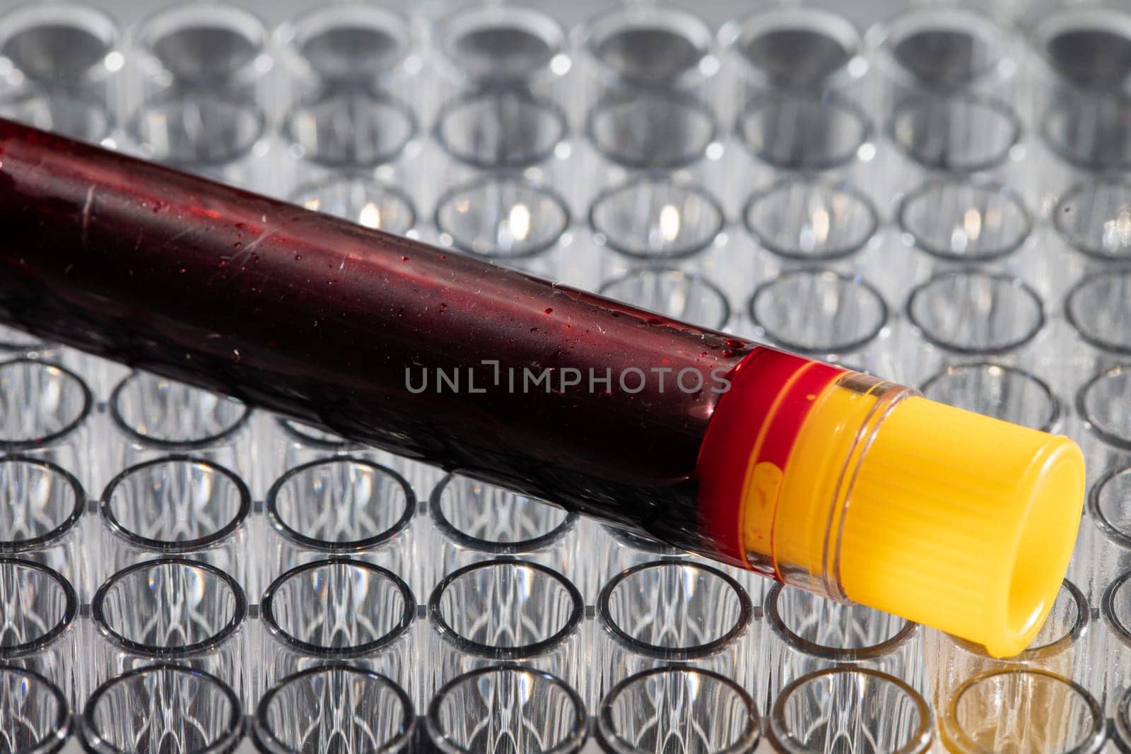 Each blood vial is transported to the laboratory for specialized tests.