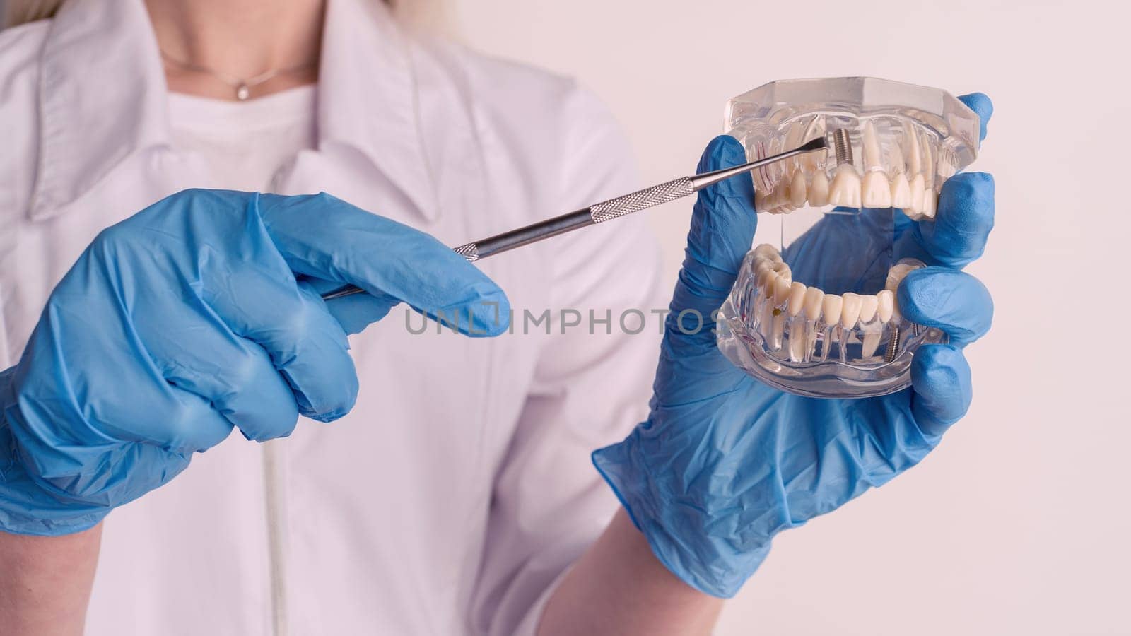 Dentist demonstrates problems with teeth on the example of the layout of the jaw - image