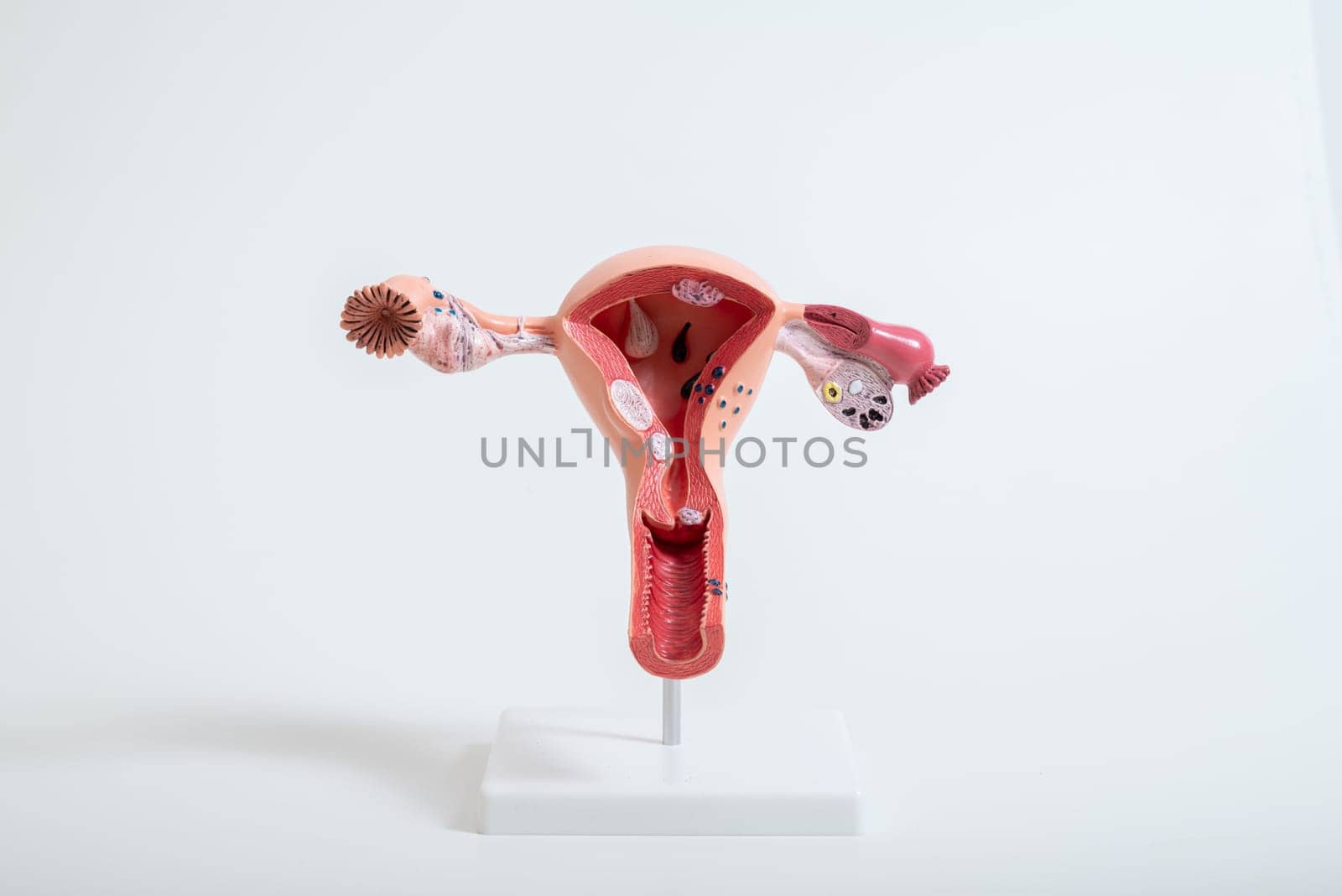 model of female reproductive system isolated on a white background