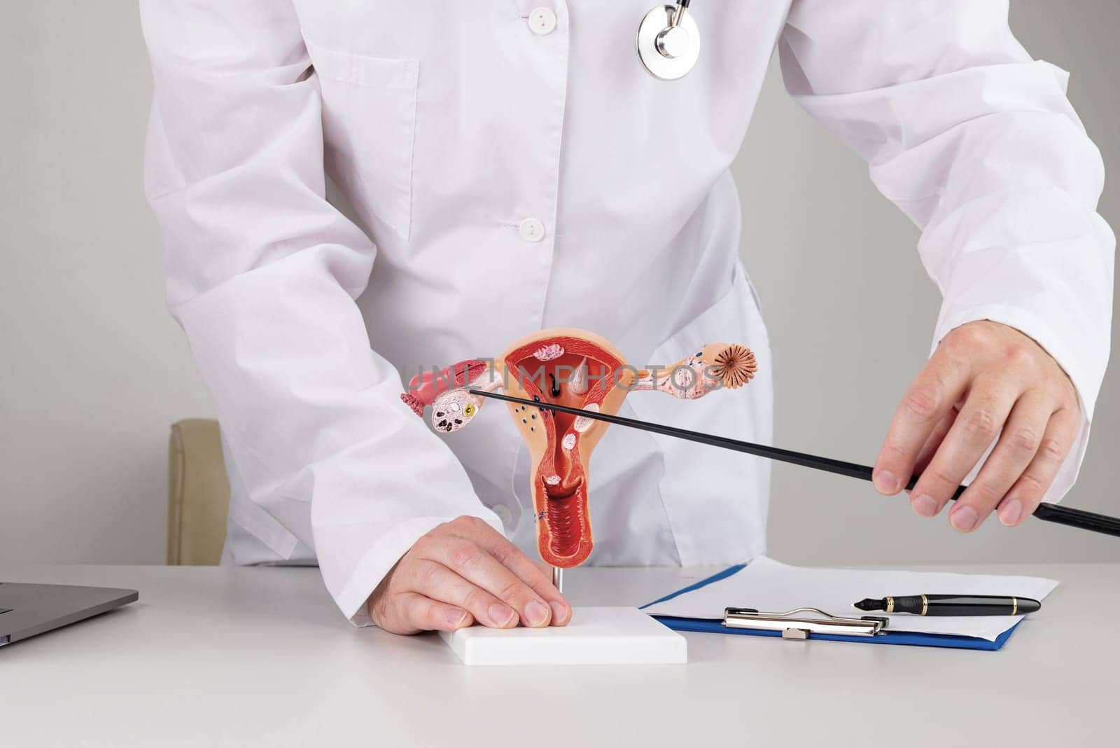 doctor gynecologist pointing model of female reproductive system on his desktop by zartarn