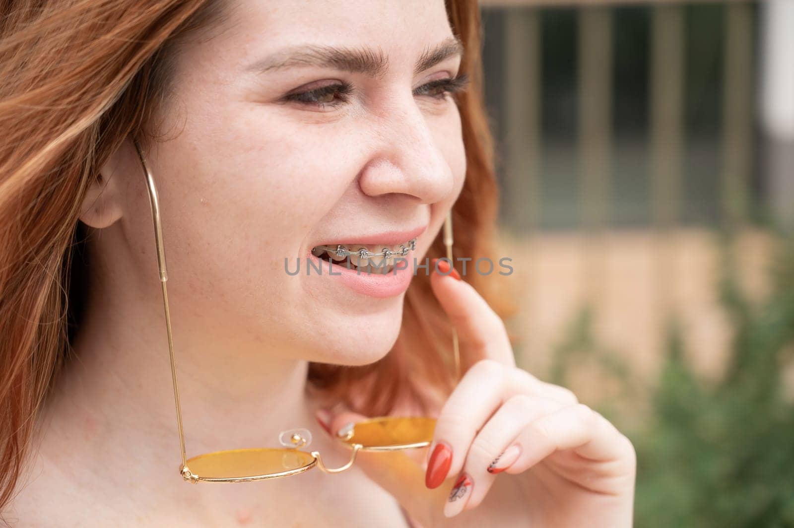 Beautiful young woman in yellow sunglasses smiling showing off braces on her teeth